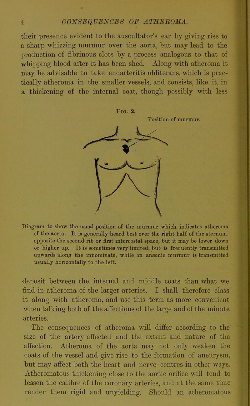 their presence evident to the auscultator’s ear by giving rise to a sharp whizzing murmur over the aorta, but may lead to the production of fibrinous clots by a process analogous to that of whipping blood after it has been shed. Along with atheroma it may be advisable to take endarteritis obliterans, which is prac- tically atheroma in the smaller vessels, and consists, like it, in a thickening of the internal coat, though possibly with less Fig. 2. Position of murmur. Diagram to show the usual position of the murmur which indicates atheroma of the aorta. It is generally heard best over the right half of the sternum, opposite the second rib or first intercostal space, but it may be lower down or higher up. It is sometimes very limited, but is frequently transmitted upwards along the innominate, while an anaemic murmur is transmitted usually horizontally to the left. deposit between the internal and middle coats than what we find in atheroma of the larger arteries. I shall therefore class it along with atheroma, and use this term as more convenient when talking both of the affections of the large and of the minute arteries. The consequences of atheroma will differ according to the size of the artery affected and the extent and nature of the affection. Atheroma of the aorta may not only weaken the coats of the vessel and give rise to the formation of aneurysm, but may affect both the heart and nerve centres in other ways. Atheromatous thickening close to the aortic orifice will tend to lessen the calibre of the coronary arteries, and at the same time render them rigid and unyielding. Should an atheromatous