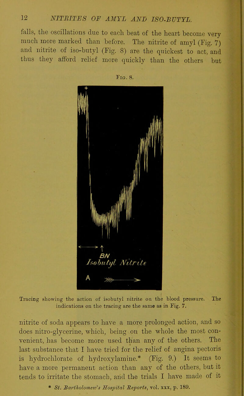 falls, the oscillations clue to each beat of the heart become very much more marked than before. The nitrite of amyl (Fig. 7) and nitrite of iso-butyl (Fig. 8) are the quickest to act, and thus they afford relief more quickly than the others but Fig. 8. Tracing showing the action of isobutyl nitrite on the blood pressure. The indications on the tracing are the same as in Fig. 7. nitrite of soda appears to have a more prolonged action, and so does nitro-glycerine, which, being on the whole the most con- venient, has become more used than any of the others. The last substance that I have tried for the relief of angina pectoris is hyclrochlorate of hydroxylamine.* (Fig. 9.) It seems to have a more permanent action than any of the others, but it tends to irritate the stomach, arid the trials I have made of it * St. Bartholomew’s Hospital Reports, vol. xxx. p. 189.