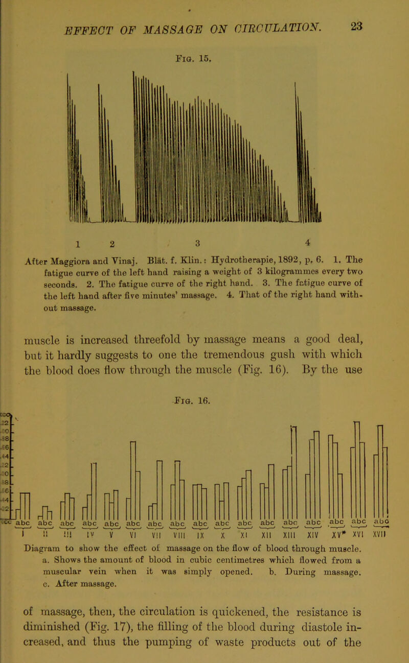 EFFECT OF MASSAGE ON CIRCULATION. Fig. 15. 12 3 4 After Maggiora and Vinaj. Bliit. f. Klin.: Hydrotherapie, 1892, p. 6. 1. The fatigue curve of the left hand raising a weight of 3 kilogrammes every two seconds. 2. The fatigue curve of the right hand. 3. The fatigue curve of the left hand after five minutes’ massage. 4. That of the right hand with- out massage. muscle is increased threefold by massage means a good deal, but it hardly suggests to one the tremendous gush with which the blood does flow through the muscle (Fig. 16). By the use Fig. 16. Diagram to show the effect of massage on the flow of blood through muscle, a. Shows the amount of blood in cubic centimetres which flowed from a muscular vein when it was simply opened. b. During massage, c. After massage. of massage, then, the circulation is quickened, the resistance is diminished (Fig. 17), the filling of the blood during diastole in- creased, and thus the pumping of waste products out of the