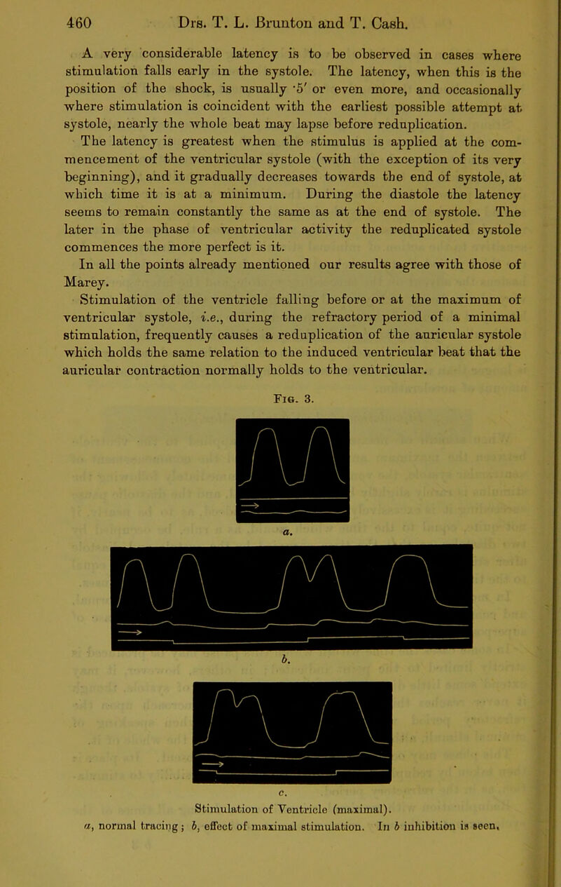 A very considerable latency is to be observed in cases where stimulation falls early in the systole. The latency, when this is the position of the shock, is usually -5' or even more, and occasionally where stimulation is coincident with the earliest possible attempt at. systole, nearly the whole beat may lapse before reduplication. The latency is greatest when the stimulus is applied at the com- mencement of the ventricular systole (with the exception of its very beginning), and it gradually decreases towards the end of systole, at which time it is at a minimum. During the diastole the latency seems to remain constantly the same as at the end of systole. The later in the phase of ventricular activity the reduplicated systole commences the more perfect is it. In all the points already mentioned our results agree with those of Marey. Stimulation of the ventricle falling before or at the maximum of ventricular systole, i.e., during the refractory period of a minimal stimulation, frequently causes a reduplication of the auricular systole which holds the same relation to the induced ventricular beat that the auricular contraction normally holds to the ventricular. Fig. 3. Stimulation of Ventricle (maximal). a, normal tracing ; b, offect of maximal stimulation. In b inhibition is seen,