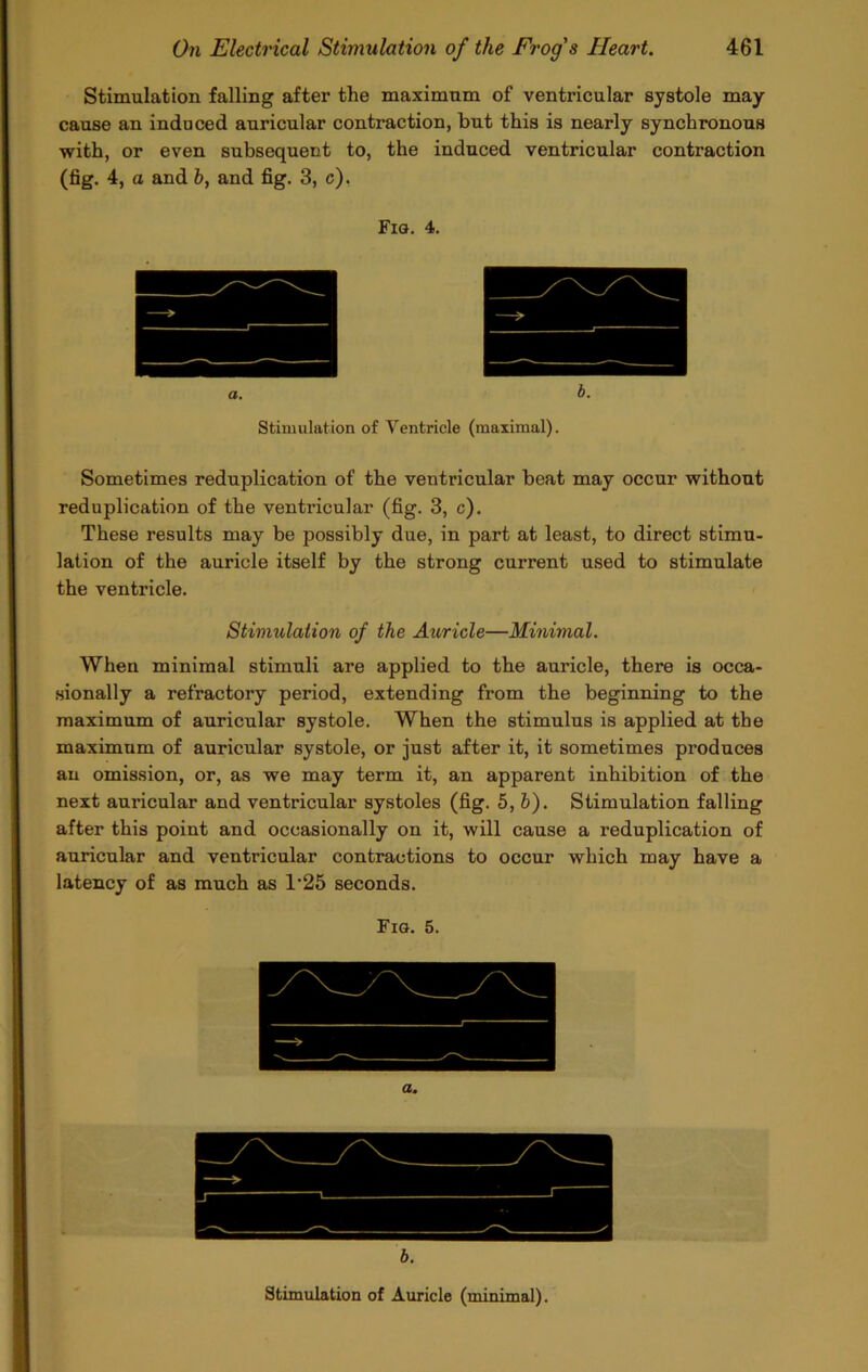 Stimulation falling after the maximum of ventricular systole may- cause an induced auricular contraction, but this is nearly synchronous with, or even subsequent to, the induced ventricular contraction (fig. 4, a and b, and fig. 3, c), Fig. 4. b. Stimulation of Ventricle (maximal). Sometimes reduplication of the ventricular beat may occur without reduplication of the ventricular (fig. 3, c). These results may be possibly due, in part at least, to direct stimu- lation of the auricle itself by the strong current used to stimulate the ventricle. Stimulation of the Auricle—Minimal. When minimal stimuli are applied to the auricle, there is occa- sionally a refractory period, extending from the beginning to the maximum of auricular systole. When the stimulus is applied at the maximum of auricular systole, or just after it, it sometimes produces an omission, or, as we may term it, an apparent inhibition of the next auricular and ventricular systoles (fig. 5, b). Stimulation falling after this point and occasionally on it, will cause a reduplication of auricular and ventricular contractions to occur which may have a latency of as much as T25 seconds. Fig. 5. a. b.