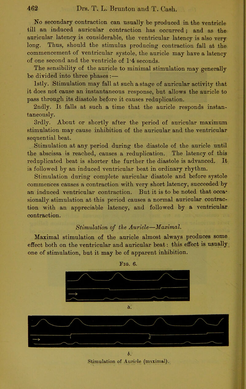 No secondary contraction can usually be produced in the ventricle till an induced auricular contraction has occurred; and as the auricular latency is considerable, the ventricular latency is also very long. Thus, should the stimulus producing contraction fall at the commencement of ventricular systole, the auricle may have a latency of one second and the ventricle of T4 seconds. The sensibility of the auricle to minimal stimulation may generally be divided into three phases :— lstly. Stimulation may fall at such a stage of auricular activity that it does not cause an instantaneous response, but allows the auricle to pass through its diastole before it causes reduplication. 2ndly. It falls at such a time that the auricle responds instan- taneously. 3rdly. About or shortly after the period of auricular maximum stimulation may cause inhibition of the auricular and the ventricular sequential beat. Stimulation at any period during the diastole of the auricle until the abscissa is reached, causes a reduplication. The latency of this reduplicated beat is shorter the further the diastole is advanced. It is followed by an induced ventricular beat in ordinary rhythm. Stimulation during complete auricular diastole and before systole commences causes a contraction with very short latency, succeeded by an induced ventricular conti’action. But it is to be noted that occa- sionally stimulation at this period causes a normal auricular contrac- tion with an appreciable latency, and followed by a ventricular contraction. Stimulation of the Auricle—Maximal. Maximal stimulation of the auricle almost always produces some effect both on the ventricular and auricular beat: this effect is usually one of stimulation, but it may be of apparent inhibition. Fig. 6. b.