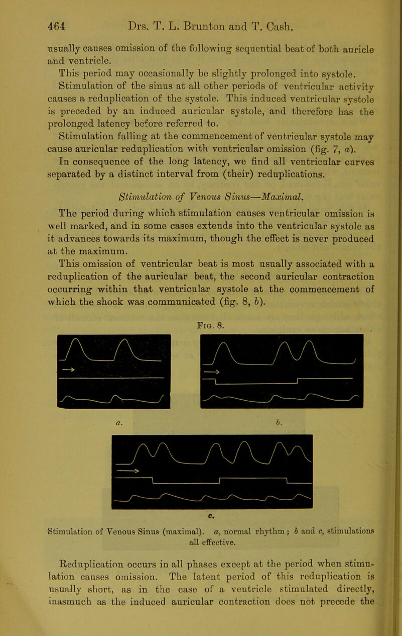 usually causes omission of the following sequential beat of both auricle and ventricle. This period may occasionally be slightly prolonged into systole. Stimulation of the sinus at all other periods of ventricular activity causes a reduplication of the systole. This induced ventricular systole is preceded by an induced auricular systole, and therefore has the prolonged latency before referred to. Stimulation falling at the commencement of ventricular systole may cause auricular reduplication with ventricular omission (fig. 7, a). In consequence of the long latency, we find all ventricular curves separated by a distinct interval from (their) reduplications. Stimulation of Venous Sinus—Maximal. The period during which stimulation causes ventricular omission is well marked, and in some cases extends into the ventricular systole as it advances towards its maximum, though the effect is never produced at the maximum. This omission of ventricular beat is most usually associated with a reduplication of the auricular beat, the second auricular contraction occurring within that ventricular systole at the commencement of which the shock was communicated (fig. 8, b). Fig. 8. c. Stimulation of Venous Sinus (maximal), a, normal rhythm; b and c, stimulations all effective. Reduplication occurs in all phases except at the period when stimu- lation causes omission. The latent period of this reduplication is usually shoi-t, as in the case of a ventricle stimulated directly, iuasmuch as the induced auricular contraction docs not precede the