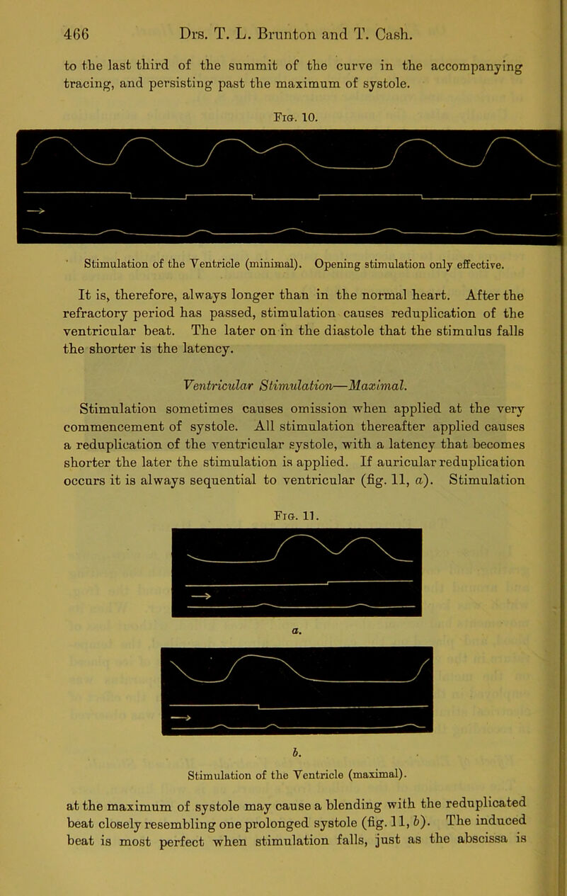 to the last third of the summit of the curve in the accompanying tracing, and persisting past the maximum of systole. Fio. 10. Stimulation of the Ventricle (minimal). Opening stimulation only effective. It is, therefore, always longer than in the normal heart. After the refractory period has passed, stimulation causes reduplication of the ventricular beat. The later on in the diastole that the stimulus falls the shorter is the latency. Ventricular Stimulation—Maximal. Stimulation sometimes causes omission when applied at the very commencement of systole. All stimulation thereafter applied causes a reduplication of the ventricular systole, with a latency that becomes shorter the later the stimulation is applied. If auricular reduplication occurs it is always sequential to ventricular (fig. 11, a). Stimulation Fig. 11. b. Stimulation of the Ventricle (maximal). at the maximum of systole may cause a blending with the reduplicated beat closely resembling one prolonged systole (fig-11, &)• The induced beat is most perfect when stimulation falls, just as the abscissa is