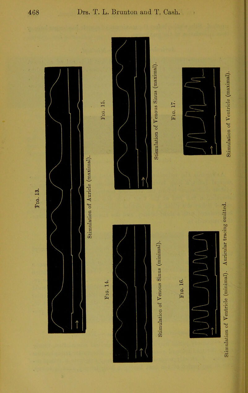 Fig. 13. Stimulation of Ventricle (minimal). Auricular tracing omitted. Stimulation of Ventricle (maximal).