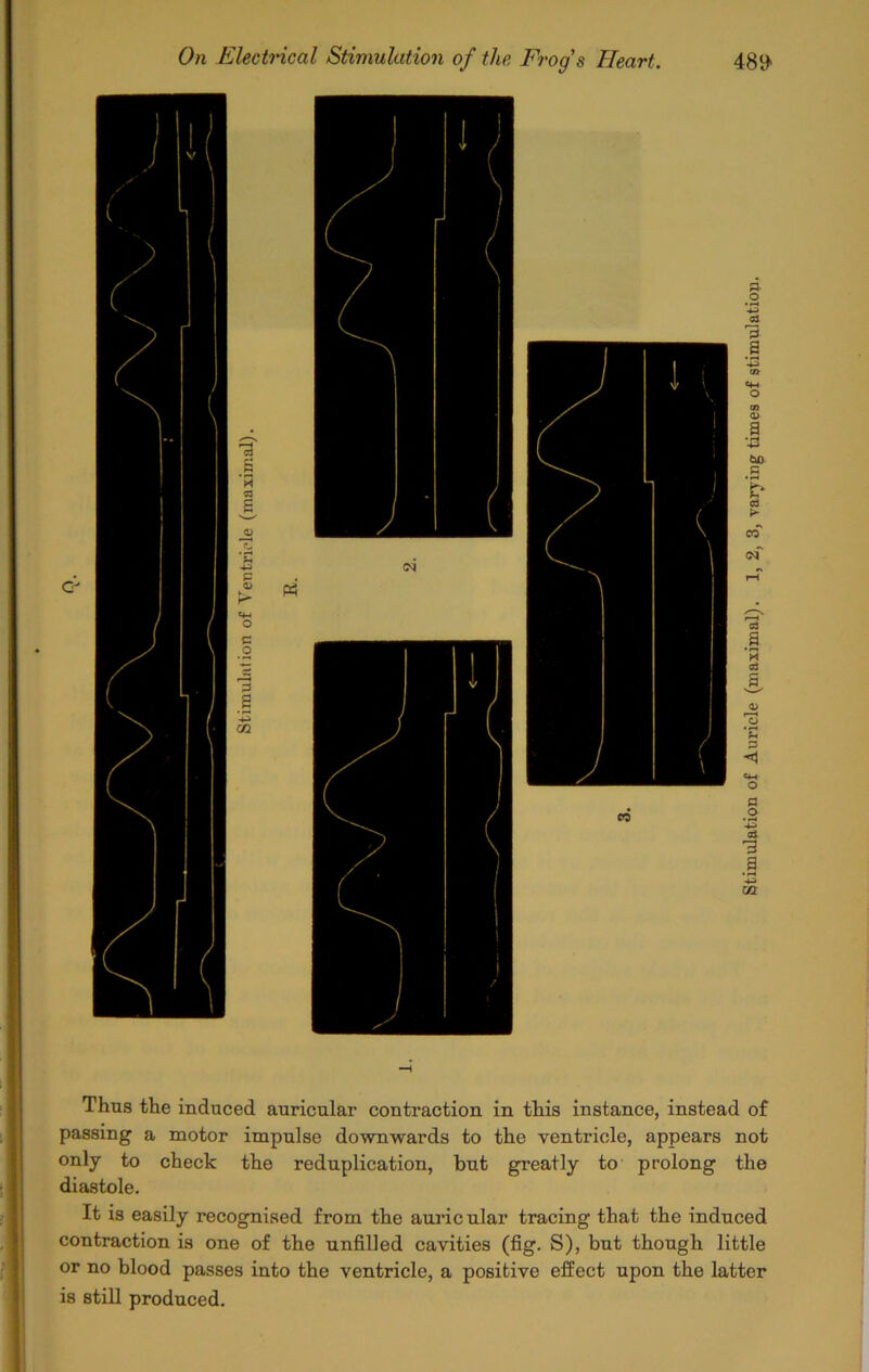 Thus the induced auricular contraction in this instance, instead of passing a motor impulse downwards to the ventricle, appears not only to check the reduplication, but greatly to prolong the diastole. It is easily recognised from the auricular tracing that the induced contraction is one of the unfilled cavities (fig. S), but though little or no blood passes into the ventricle, a positive effect upon the latter is still produced.