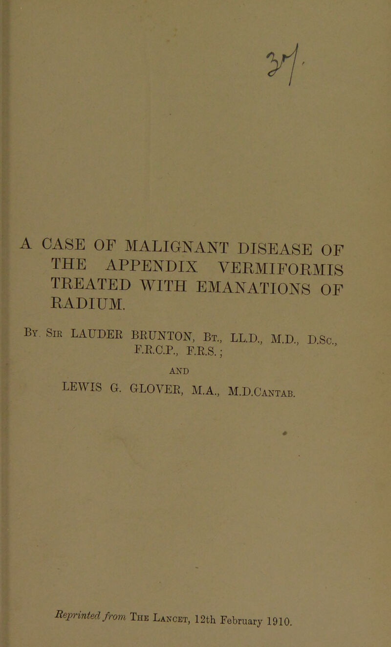 A CASE OF MALIGNANT DISEASE OF THE APPENDIX VERMIFORMIS TREATED WITH EMANATIONS OF RADIUM. B\ Sir LAUDER BRUNTON, Bt., LL.D., M.D D Sc F.R.O.P., F.R.S.; AND LEW IS G. GLOVER, M.A., M.D.Cantab. Reprinted from The Lancet, 12th February 1910.