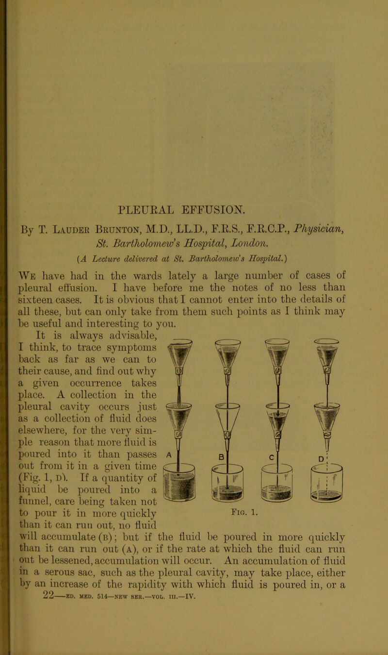 By T. Lauder Brunton, M.D., LL.D., F.R.S., F.R.C.P., Physician, St. Bartholomews Hospital, London. (A Lecture delivered at St. Bartholomew's Hospital.) We have had in the wards lately a large mini her of cases of pleural effusion. I have before me the notes of no less than sixteen cases. It is obvious that I cannot enter into the details of all these, but can only take from them such points as I think may he useful and interesting to you. It is always advisable, I think, to trace symptoms back as far as we can to their cause, and find out why a given occurrence takes place. A collection in the pleural cavity occurs just as a collection of fluid does elsewhere, for the very sim- ple reason that more fluid is poured into it than passes out from it in a given time (Fig. 1, d\ If a quantity of liquid lie poured into a funnel, care being taken not to pour it in more quickly than it can run out, no fluid will accumulate (b) ; but if the fluid be poured in more quickly than it can run out (a), or if the rate at which the fluid can run out be lessened, accumulation will occur. An accumulation of fluid in a serous sac, such as the pleural cavity, may take place, either by an increase of the rapidity with which fluid is poured in, or a 22 ED. MED. 514—NEW SKR.—VOL. 111.—IV. w ■ Fig. 1.