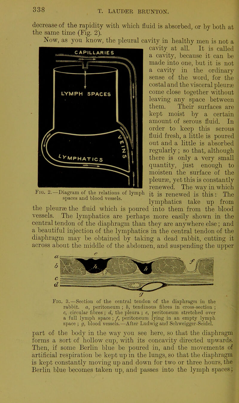 decrease of the rapidity with which fluid is absorbed, or by both at the same time (Fig. 2). Now, as you know, the pleural cavity in healthy men is not a cavity at all. It is called a cavity, because it can be made into one, but it is not a cavity in the ordinary sense of the word, for the costal and the visceral pleurae come close together without leaving any space between them. Their surfaces are kept moist by a certain amount of serous fluid. In order to keep this serous fluid fresh, a little is poured out and a little is absorbed regularly ; so that, although there is only a very small quantity, just enough to moisten the surface of the pleurae, yet this is constantly renewed. The way in which Fig. 2.—Diagram of the relations of lymph jq js renewed is this: The spaces and blood vessels. i , • . i P lymphatics take up irom the pleurae the fluid which is poured into them from the blood vessels. The lymphatics are perhaps more easily shown in the central tendon of the diaphragm than they are anywhere else ; and a beautiful injection of the lymphatics in the central tendon of the diaphragm may be obtained by taking a dead rabbit, cutting it across about the middle of the abdomen, and suspending the upper Fig. 3.—Section of the central tendon of the diaphragm in the rabbit, a, peritoneum ; b, tendinous fibres in cross-section ; c, circular fibres ; d, the pleura ; e, peritoneum stretched over a full lymph space ; /, peritoneum lying in an empty lymph space ; g, blood vessels.-—After Ludwig and Schweigger-Seidel. part of the body in the way you see here, so that the diaphragm forms a sort of hollow cup, with its concavity directed upwards. Then, if some Berlin blue be poured in, and the movements of artificial respiration be kept up in the lungs, so that the diaphragm is kept constantly moving up and down for two or three hours, the Berlin blue becomes taken up, and passes into the lymph spaces;