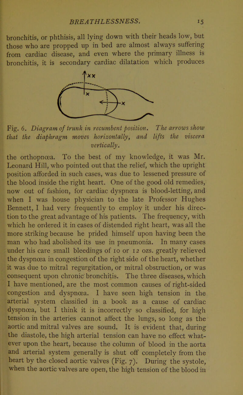 bronchitis, or phthisis, all lying down with their heads low, but those who are propped up in bed are almost always suffering from cardiac disease, and even where the primary illness is bronchitis, it is secondary cardiac dilatation which produces Fig. 6. Diagram of trunk in recumbent position. The arrows show that the diaphragm moves horizontally, and lifts the viscera vertically. the orthopnoea. To the best of my knowledge, it was Mr. Leonard Hill, who pointed out that the relief, which the upright position afforded in such cases, was due to lessened pressure of the blood inside the right heart. One of the good old remedies, now out of fashion, for cardiac dyspnoea is blood-letting, and when I was house physician to the late Professor Hughes Bennett, I had very frequently to employ it under his direc- tion to the great advantage of his patients. The frequency, with which he ordered it in cases of distended right heart, was all the more striking because he prided himself upon having been the man who had abolished its use in pneumonia. In many cases under his care small bleedings of 10 or 12 ozs. greatly relieved the dyspnoea in congestion of the right side of the heart, whether it was due to mitral regurgitation, or mitral obstruction, or was consequent upon chronic bronchitis. The three diseases, which I have mentioned, are the most common causes of right-sided congestion and dyspnoea. I have seen high tension in the arterial system classified in a book as a cause of cardiac dyspnoea, but I think it is incorrectly so classified, for high tension in the arteries cannot affect the lungs, so long as the aortic and mitral valves are sound. It is evident that, during the diastole, the high arterial tension can have no effect what- ever upon the heart, because the column of blood in the aorta and arterial system generally is shut off completely from the heart by the closed aortic valves (Fig. 7). During the systole, when the aortic valves are open, the high tension of the blood in
