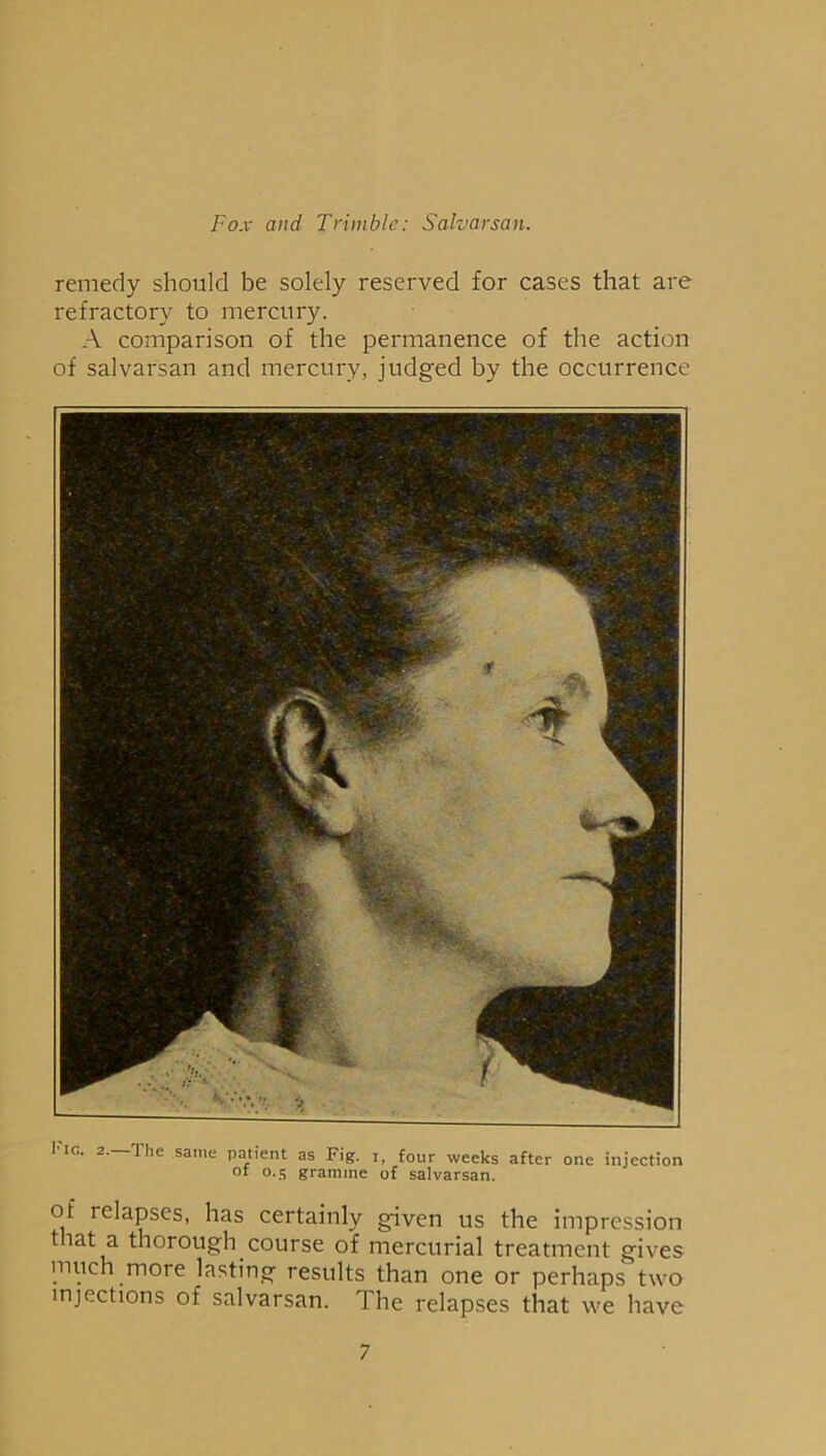 remedy should be solely reserved for cases that are refractory to mercury. A comparison of the permanence of the action of salvarsan and mercury, judged by the occurrence I'ig. 2.—The same patient as Fig. i, four weeks after one injection of 0.5 gramme of salvarsan. ot relapses, has certainly given us the impression tiat a thorough course of mercurial treatment gives much more lasting results than one or perhaps two injections of salvarsan. The relapses that we have