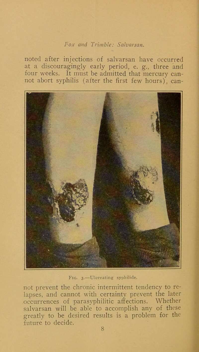 noted after injections of salvarsan have occurred at a discouragingly early period, e. g., three and four weeks. It must be admitted that mercury can- not abort syphilis (after the first few hours), can- Fig. 3.—Ulcerating sypliilide. not prevent the chronic intermittent tendency to re- lapses, and cannot with certainty prevent the later occurrences of parasyphilitic affections. Whether salvarsan will be able to accomplish any of these greatly to be desired results is a problem for the future to decide.