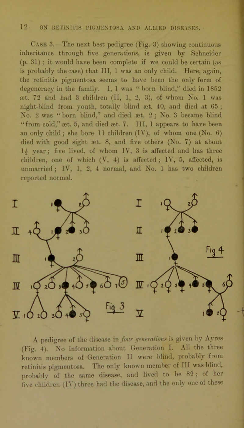 Case 3.—The next best pedigree (Fig. 3) showing continuous inheritance through five generations, is given by Schneider (p. 31) ; it would have been complete if Ave could be certain (as is probably the case) that III, 1 was an only child. Here, again, the retinitis pigmentosa seems to have been the only form of degeneracy in the family. I, 1 was “born blind,” died in 1852 ret. 72 and had 3 children (II, 1, 2, 3), of whom No. 1 was night-blind from youth, totally blind art. 40, and died at 65 ; No. 2 was “born blind,” and died set. 2 ; No. 3 became blind “from cold,” set. 5, and died set. 7. Ill, 1 appears to have been an only child; she bore 11 children (IV), of whom one (No. 6) died with good sight set. 8, and five others (No. 7) at about H year; five lived, of whom IV, 3 is affected and has three children, one of which (V, 4) is affected; IV, 5, affected, is unmarried; IV, 1, 2, 4 normal, and No. 1 has two children reported normal. A pedigree of the disease in four generations is given by Ayres (Fig. 4). No information about Generation I- All the three known members of Generation II were blind, probably from retinitis pigmentosa. The only known member of III was blind, probably of the same disease, and lived to be 89; of her five children (IV) three had the disease, and the only one of these