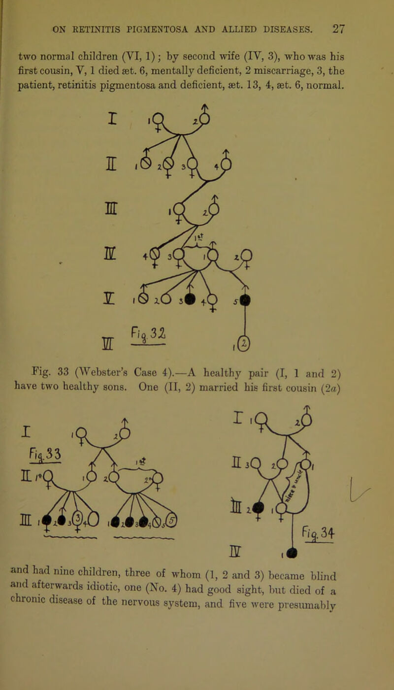 two normal children (VI, 1); by second wife (IV, 3), who was his first cousin, V, 1 died set. 6, mentally deficient, 2 miscarriage, 3, the patient, retinitis pigmentosa and deficient, set. 13, 4, set. 6, normal. Fig. 33 (Webster’s Case 4).—A healthy pair (I, 1 and 2) have two healthy sons. One (II, 2) married his first cousin (2a) and had nine children, three of whom (1, 2 and 3) became blind and afterwards idiotic, one (No. 4) had good sight, but died of a chronic disease of the nervous system, and five were presumably