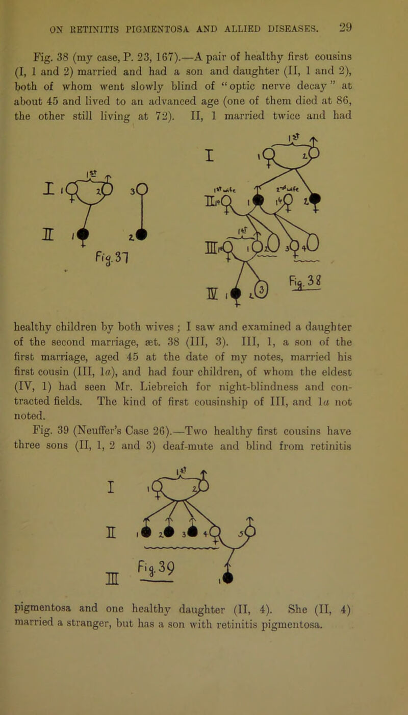 Fig. 38 (my case, P. 23, 167).—A pair of healthy first cousins (I, 1 and 2) married and had a son and daughter (II, 1 and 2), both of whom went slowly blind of “ optic nerve decay ” at about 45 and lived to an advanced age (one of them died at 86, the other still living at 72). II, 1 married twice and had healthy children by both wives; I saw and examined a daughter of the second marriage, set. 38 (III, 3). Ill, 1, a son of the first marriage, aged 45 at the date of my notes, married his first cousin (III, la), and had four children, of whom the eldest (IV, 1) had seen Mr. Liebreich for night-blindness and con- tracted fields. The kind of first cousinship of III, and la not noted. Fig. 39 (Neuffer’s Case 26).—Two healthy first cousins have three sons (II, 1, 2 and 3) deaf-mute and blind from retinitis pigmentosa and one healthy daughter (II, 4). She (II, 4) married a stranger, but has a son with retinitis pigmentosa.