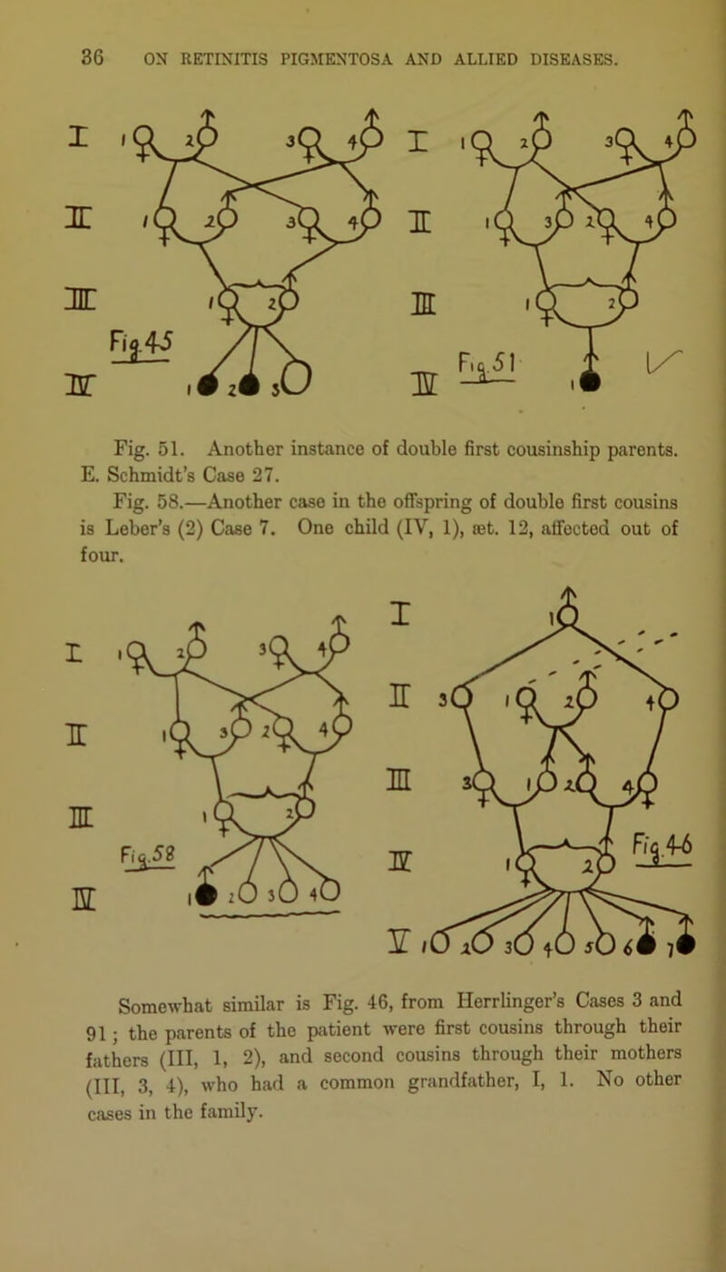 Fig. 51. Another instance of double first cousinship parents. E. Schmidt’s Case 27. Fig. 58.—Another case in the offspring of double first cousins is Leber’s (2) Case 7. One child (IV, 1), jet. 12, atfoctod out of four. t IT m EC Somewhat similar is Fig. 46, from Herrlinger’s Cases 3 and 91 . the parents of the patient were first cousins through their fathers (III, 1, 2), and second cousins through their mothers (III, 3, 4), who had a common grandfather, I, 1. No other cases in the family.