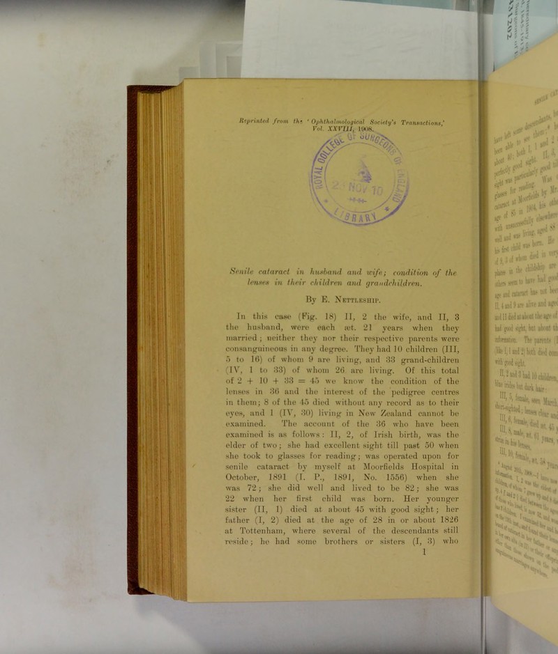 Reprinted from th- ' Ophthalmologieal Society's Transactions’ Vol. XXVIII, 1908. Senile cataract in husband and wife; condition of the lenses in their children and grandchildren. By E. Nettleship. In this case (Kig. 18) II, 2 the wife, ami II, 3 the husband, were each jet. 21 years when they married ; neither they nor their respective parents were consanguineous in any degree. They had 10 children (III, 5 to 16) of whom 9 are living, and 33 grand-children (IV, 1 to 33) of whom 26 are living. Of this total of 2 + 10 + 33 = 45 we know the condition of the lenses in 36 and the interest of the pedigree centres in them; 8 of the 45 died without any record as to their eyes, and 1 (IV, 30) living in New Zealand cannot be examined. The account of the 36 who have been examined is as follows: II, 2, of Irish birth, was the elder of two; she had excellent sight till past 50 when she took to glasses for reading; was operated upon for senile cataract by myself at Moorfields Hospital in October, 1891 (I. P., 1891, No. 1556) when she was 72; she did well and lived to be 82; she wjis 22 when her first child was born. Her younger sister (II, 1) died at about 45 with good sight; her father (I, 2) died at the age of 28 in or about 1826 at Tottenham, where several of the descendants still reside; he had some brothers or sisters (I, 3) who 1 k *i7**is i1-3, aboo1 j „ ^ * ‘ 10,4, ** . pD * \ j, ^ -n * * otheis seem to have ud cataract btf t>< W II. 4 ind 9 are alite and atv and 11 died it aUnt the «■! y good bit ah lit t! ilforaaiM. Thf ]<an T t» Ifc I, I and b both died co» itb good sight. II, 2 »d 3 had 10 children ^•incesWdtrlbur ,I[,5. tale, seen W K. tii’, }+ 1> fwaale, - :4 10*.‘^il- -v L , * '■* i.ifcl ■ **»*. %(L. '>'u. *