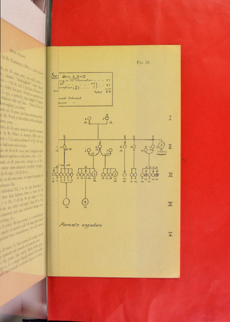 f)y w • r. pi lie ■ *t. o7 Fig. 18. ; '■ 1  •) ■ i thomd. ct|on is | S2S,^8 a-n< ] fitns. II,log t*r»Q Of r\o in for m atiovt - 37 CxT + «n ortfiition ... 7 / Total 8 4 47 rtccd- Cataract (oicrtt •> il \|„ n- J j<ars> Ifas been i *'•*«» tlN* even yean. bv '1 j? years, < it i ' „ p|slw‘r. m January, 1907, aid a f ' O.awl* cylinder bad some axial myopia, if. ail 1> or HI years, seen; marginalstrie ttoiTil opacities in both lenses; lias - 2D. iiihIc. ;ti 4/ years, seen; changes a> in No. rather iiW# advanced; irregular myopia; U mil - 'y■> !'• l°r ^ . . I, r[ 4i years, seen; w trace of opanty i (.traction Km. iQgt described, 7 imlivulualt ■'0. total of % i to fwi»1810 ' v alive. cbang« are / oi K» ffltO an> H X XX 6 HI •V 1 '.7 '» '9 y fib. 30 oK oi. 32 35 AS 6 © 34 tthe*' 'll some ,al 1* well ,.*■»< ■  ■LJi**! . from J-hre/z/j anywAe/-e .. V^'lof^ies^ . liii* i-i 35 nr