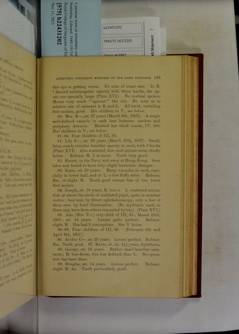 TRACTS 1617(10) b22431202 c <U E CL O vO ^2 Kircif afi3QR7 1 AFFECTING DIFFERENT MEMBERS OF THE SAME PEDIGREE. 243 this eye is getting worse. No note of exact size. In R. ? discoid subtriangular opacity with three knobs, the up- out one specially large (Plate XVI). No cortical spokes. Moves very much “ against ” the iris. No note as to relative size of cataract in R. and L. All teeth, including first molars, good. His children in V., see below. 80. Mrs. R—, net. 27 years (March 9th, 1907). A single well-defined vacuole in each lens between nucleus and periphery down-in. Married her third cousin, IV, 100. Her childi’en in V., see below. 81-84. Four children of III, 34. 81. Lily S—, mt. 23 years (March 27th, 1907). Small, faint, nearly circular lamellar opacity in each, with 3 knobs (Plate XVI). Also scattered dots and minute striie chiefly below. Refract. H. 2 or more. Teeth very good. 82. Ernest, in the Navy and away at Hong-Kong. Seen later and found to have very slight lenticular changes. 83. Katie, set. 20 yeai’s. Many vacuoles in each, espe- cially in lower half, and in L. a few fluffy strue. Refract. Em. or slight H. Teeth good except loss of two lower first molars. 84. Joseph, let. 18 years, R. lens n. L. scattered minute dots at about the circle of undilated pupil, quite in anterior cortex ; best seen by direct ophthalmoscopy, only a few of them seen by focal illumination. (No mydriatic used, so there may have been others concealed by iris.) (Plate XVI.) 85. Ada (Mrs. T—) only child of III, 35 ; March 27th, 1907 ; mt. 24 years. Lenses quite perfect. Refract, slight H. Has had 3 conceptions. See V below. 86-89. Four children of III, 36. (February 9th and April 6th, 1907.) 86. Archie C—, set. 23 years. Lenses perfect. Refract. Em. Teeth good. 87. Katie, oh. set. 3|# years, diphtheria. 88. George, mt. 18 years. Rather small lamellar cata- racts ; R. less dense, but less defined, than L. No opera- tion has been done. 89. Douglas, aet. 14 years. Lenses perfect, slight M. As. Teeth particularly good. Refract.