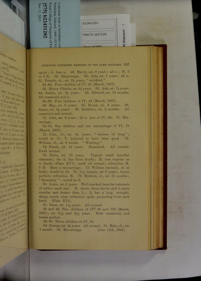 (Ji o .D PN^iii, ft**. »0t ■1! ’*>■, wjlS vbvL^* IV Kf. , *,««. 1 J (Apnl, I90JJ v :W*«,,!,, »«; ,.ir' •1 ^Wked retinitis «. 19years;kses Hip, 8t li years; not seen; 1. Edward,*!. 16years; lenses l-inarked retinitis pigmentosa. 1 years: all n, II. Frank, st, misfarmsps. V, 32. , tynifal small, dense, *'-■ vs:: 1|,'t’X,.1'1U^J,Miiaotener Mhl !’W acnole B if cataract “• r-1 »'*>*% Tv 12 (Ma«bVl^l8^; f !'• 1/0* .itf# ,■01- ji colir' all- R.»v ,0^’ z O a. < ~~A ^ - (Ji “ - k— ^ O’ = ~ TO ^ bJ « 2, I—* c N> ct3 o 8 N> 3 C/3 Z > !. n n £ C/3 C — -S' 3 m o a- a S 3 $ 2 a. ♦ - 3 — n> * 1 L/l — s o « C? —*3 ^ ^ [H .. o 3 n 3 b22431202 TRACTS 1617(10) 1 /Qircil C CL) E a. !c to O AFFECTING DIFFERENT MEMBERS OF THE SAME PEDIGREE. 24/ up-in ; L. lens n. 58. Harry, set. 9 years ; all n. ; H. 5 or 6 D. 59. Miscarriage. 60. Ada, fet. 5 years; all n. 61. Female, ob., aet. 2^ years, “ accident.” 62—65. Four children of IV, 43 (March, 1907). 62. Henry Charles, set. 8| years. 63. Ada, set. 7i years. 64. Jackie, aet. 3| years. 65. Edward, aet. 12 months. All examined and n. 66-69. Four children of IV, 44 (March, 1907). 66. May, aet. 9 years. 67. Norah, aet. 8 years. 68. James, set. 4| years. 69. Kathleen, aet. 2 months. All examined and normal. 70. John, set. 6 years ; all n. (son of IV, 49). 71. Mis- carriage. 72—81. Ten children and one miscarriage of IV, 79 (March, 1907). 72. John, ob., act. 4£ years; “abscess of lung”; would be 17; V. believed to have been good. 73. William, ob., set. 6 weeks. “Wasting.” 74. Frank, net. 14 vears. Examined. All normal. * *> Teeth normal. 75. Doris, aet. 13 years. Typical small lamellar cataracts; the L. has three knobs; R. less regular as to knobs (Plate XVI) ; teeth all normal; refraction H. 5 D. Here a miscarriage. 77. William (second), ob. at birth; would be 10. 78. Ivy, female, aet. 9 years; lenses perfect; refraction H. 79. Mildred, ob., aet. 11. months; “ dysentery ” ; would be 8. 80. Louis, set. 5 years. Well-marked lamellar cataracts of rather small size. R. shows three knobs and is more circular and denser than L.; L. has a long, straight, sharp, nearly clear refraction spoke projecting from each knob. (Plate XVI). 81. Irene, aet. ly^ years. All normal. 82 and 83. Two children of IV7 80 and 100 (March, 1907); aet. 6yV and 4-^- years. Both examined, and lenses perfect. 84-86. Three children of IV, 85. 84. George, aet. 4J years. All normal. 85. Male, ob., set. 1 month. 86. Miscarriage. (June 11th, 1908.) . f I