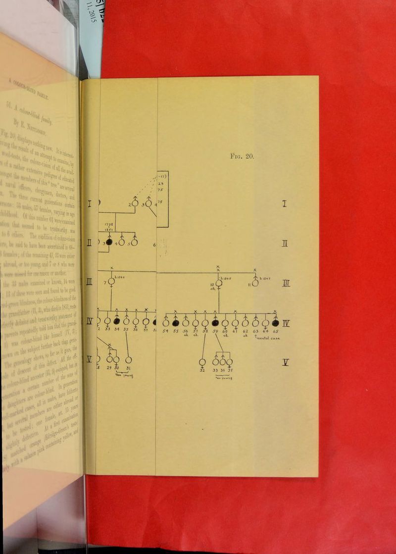 IV k a %T 41 % % t x **ni ,vll|,Ccs^.... Hiiiir.i ,i ' ' x,en»iv6 pedj^. e ava'l- ,1 ‘ ^ ln,‘,Bbers of ti-uf860 ^“«ted '> «av;.: Ills tree. ™ ■ r!i mT9n' lloclorv^ Fig. 20. •:» mal^ 571 , ,ll! «ron m 11,,;.' ution tu 7,lfflW«^^ed .' , 7 * W trustworthy *  111 wife oi colour-vision ri' 1,1 liave been ascertained in 69- 1 tVniiilr', of the remaining H, 33 were either iiimnid, «r Imi vornijf, ami 1 nr H vho were ttetv hhwiI fnr one reran or anotlier. m, ni.ilo^ examined or Vnowu, U were 14J ,.f these «fre seen and found to be good statement of I > H > XO 6 n -si*-** tin'#1 ,ar^itr>ls i!S C A X X X , ~2>' E 1 r1—T ¥ T T X XX a 1 X X ff !' 9 i 6 <t> ^ 4 m 1 33 34 JS 3<S 57 31 ss S6 Jj f~s S9 £b 61 62 63 64- 6S oh- oh. ol. oV ^ mental 1  ,#,,,,1 lnfe ' have , ||S ij«fi ■ fl!n |5 ve*15 <V’ u 1 oin rir-t el. isdj 32 33 34 39 • y--nj i. u , 1 At1 e-en5 j lKl j# ' n(ait,'l'B ‘ J