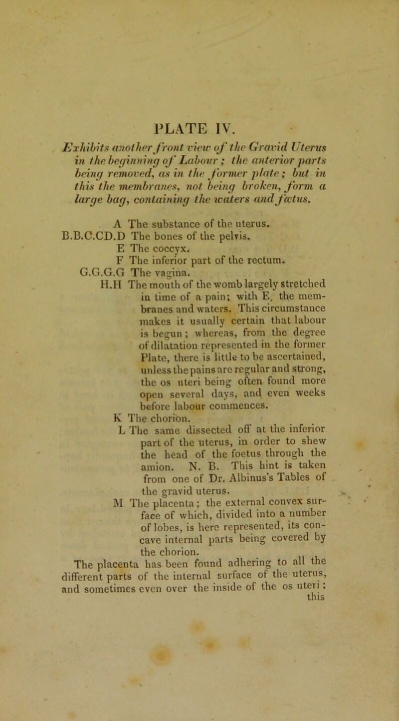 Exhibits another J'ront vine of the Gravid Uterus in the beyinning of Labour; the anterior parts being removed, as in the former plate ; but in this the membranes, not being broken, form a large bag, containing the waters and fcctus. A The substance of the uterus. B.B.C.CD.D The bones of the pelvis. E The coccyx. F The inferior part of the rectum. G.G.G.G The vagina. H.II The mouth of the womb largely stretched in time of a pain; with E. the mem- branes and waters. This circumstauce makes it usually certain that labour is begun; whereas, from the degree of dilatation represented in the former Plate, there is little to be ascertained, unless the pains are regular and strong, the os uteri being often found more open several days, and even weeks before labour commences. K The chorion. L The same dissected off at the inferior part of the uterus, in order to shew the head of the foetus through the amion. N. B. This hint is taken from one of Dr. Albinuss Tables of the gravid uterus. M The placenta; the external convex sur- face of which, divided into a number of lobes, is here represented, its con- cave internal parts being covered by the chorion. The placenta has been found adhering to all the different parts of the internal surface of the uterus, and sometimes even over the inside of the os uteri; this