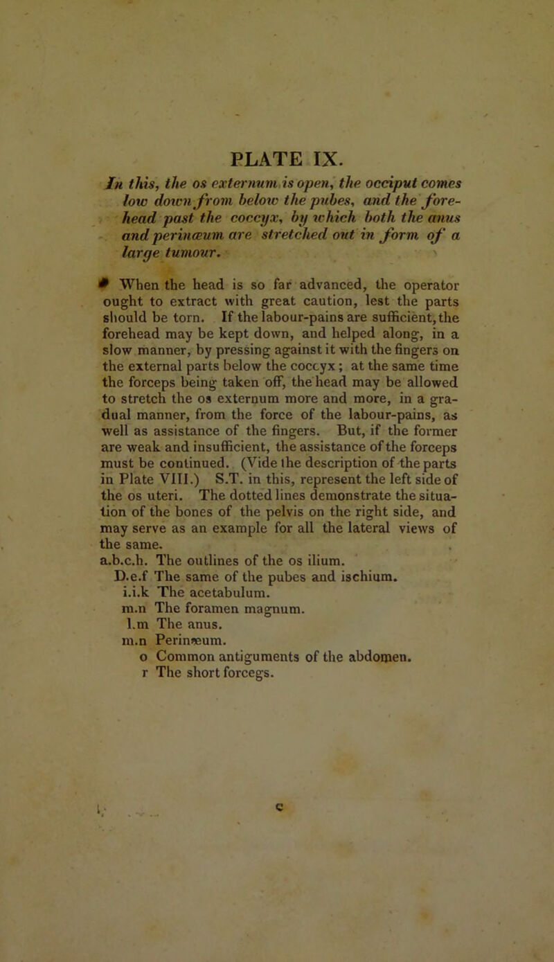 In this, the os externum is open, the occiput comes low down from below the pubes, and the fore- head past the coccyx, by which both the anus and perineeum are stretched out, in form of a large tumour. * When the head is so far advanced, the operator ought to extract with great caution, lest the parts should be torn. If the labour-pains are sufficient, the forehead may be kept down, and helped along, in a slow manner, by pressing against it with the fingers on the external parts below the coccyx; at the same time the forceps being taken off, the head may be allowed to stretch the os externum more and more, in a gra- dual manner, from the force of the labour-pains, as well as assistance of the fingers. But, if the former are weak and insufficient, the assistance of the forceps must be continued. (Vide the description of the parts in Plate VIII.) S.T. in this, represent the left side of the os uteri. The dotted lines demonstrate the situa- tion of the bones of the pelvis on the right side, and may serve as an example for all the lateral views of the same. a.b.c.h. The outlines of the os ilium. D.e.f The same of the pubes and ischium, i.i.k The acetabulum, m.n The foramen magnum. l. m The anus. m. n Perin*um. o Common antiguments of the abdomen, r The short forcegs. c