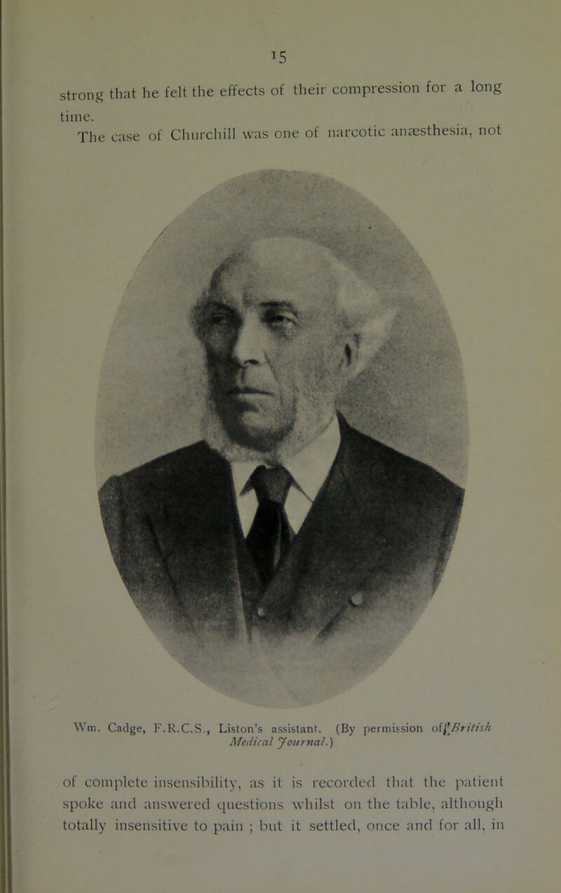 strong that he felt the effects of their compression for a long time. The case of Churchill was one of narcotic anaesthesia, not Wm. Cadge, F.R.C.S., Liston’s assistant. (By permission of[British Medical Journal.) of complete insensibility, as it is recorded that the patient spoke and answered questions whilst on the table, although totally insensitive to pain ; but it settled, once and for all, in