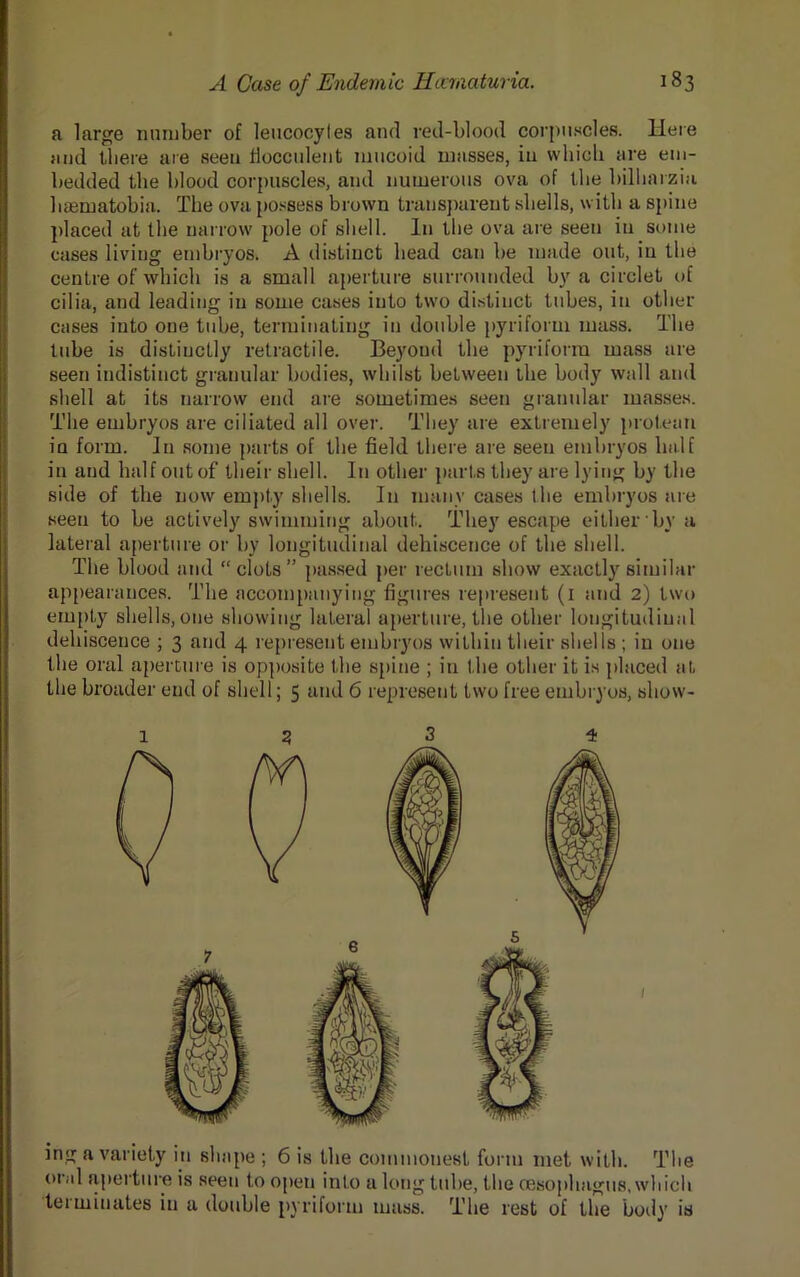 a large number of leucocyles and red-blood corpuscles. Here and there are seen Hocculent mucoid masses, in vvhicli are em- bedded the blood corpuscles, and numerous ova of the bilharzia luematobia. The ova possess brown transparent shells, with a spine placed at the narrow pole of shell. In the ova are seen in some cases living embryos. A distinct head can be made out, in the centre of which is a small aperture surrounded by a circlet of cilia, and leading in some cases into two distinct tubes, in other cases into one tube, terminating in double pyriform mass. The tube is distinctly retractile. Beyond the pyriform mass are seen indistinct granular bodies, whilst between the body wall and shell at its narrow end are sometimes seen granular masses. The embryos are ciliated all over. They are extremely protean in form. In some parts of the field there are seen embryos half in and half out of their shell. In other parts they are lying by the side of the now empty shells. In many cases the embryos are seen to be actively swimming about. They escape either bv a lateral aperture or by longitudinal dehiscence of the shell. The blood and “clots” passed per rectum show exactly similar appearances. The accompanying figures represent (1 and 2) two empty shells, one showing lateral aperture, the other longitudinal dehiscence ; 3 and 4 represent embryos within their shells ; in one the oral aperture is opposite the spine ; in the other it is placed at the broader end of shell; 5 and 6 represent two free embryos, sliow- 1 3 3 4 ing a variety in shape ; 6 is the commonest form met with. The oral aperture is seen to open into a long tube, the oesophagus, which terminates in a double pyriform mass. The rest of the body is