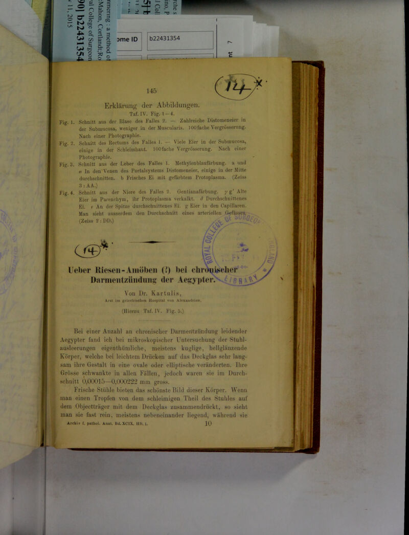 I W M 5 o Dme ID b22431354 ZI 145 Erklärung der Abbildungen. Taf. IV. Fig. 1-4. Fig. 1. Schnitt aus der Blase des Falles 2. — Zahlreiche Distomeneier in der Submucosa, weniger in der Muscularis. 100 fache Vergrösserung. Nach einer Photographie. Fig. 2. Schnitt des ßectums des Falles I. — Viele Eier in der Submucosa, einige in der Schleimhaut. 100 fache Vergrüsserung. Nach einer Photographie. Fig. 3. Schnitt aus der Leber des Falles 1. Methylenblaufärbung, a und a In den Venen des Portalsystems Distomeneier, einige in der Mitte durchschnitten, b Frisches Ei mit gefärbtem Protoplasma. (Zeiss 3 : AA.) Fig. 4. Schnitt aus der Niere des Falles 2. Gentianafärbung. y g' Alte Eier im Parenchym, ihr Protoplasma verkalkt. <f Durchschnittenes Ei. f An der Spitze durchschnittenes Ei. g Eier in den Capillaren. Man sieht ausserdem den Durchschnitt eines arteriellen Gefässes. /r/ o . TA T V V Bei einer Anzahl an chronischer Darmentzündung leidender Aegypter fand ich bei mikroskopischer Untersuchung der Stuhl- ausleerungen eigenthümliche, meistens kuglige, hellglänzende Körper, welche bei leichtem Drücken auf das Deckglas sehr lang- sam ihre Gestalt in eine ovale oder elliptische veränderten. Ihre Grösse schwankte in allen Fällen, jedoch waren sie im Durch- schnitt 6,00015—0,000222 mm gross. Frische Stühle bieten das schönste Bild dieser Körper. Wenn mau einen Tropfen von dem schleimigen Theil des Stuhles auf dem Objectträger mit dem Deckglas zusammendrückt, so sieht man sie fast rein, meistens nebeneinander liegend, während sie Archiv f. pathol. Anat. Bd.XCIX. Hfl. 1. 10 \ Von Dr. Kartulis, Arzt im griechischen Hospital von Alexandrien.