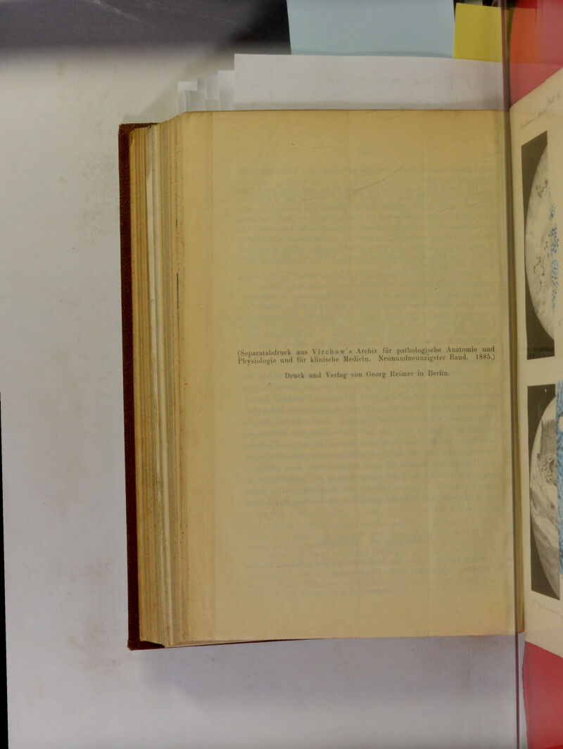 (Senarutabdruck aus Yirchow's Archiv für pathologische Anatomie und Physiologie und für klinische Mediein. Neunundnemmgster Hand. 188a.) Druck und Verlag von Georg Keimet- in Berlin.