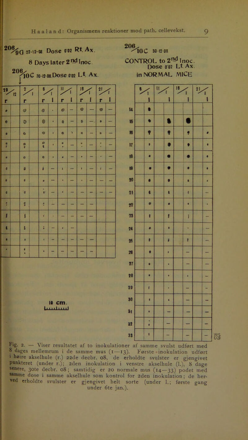 202øG 22-12-08 Dose 002 Rt. Ax 8 Days later 2 Od lnoc 2°^10C 30-12 08 Dose 002 Lt. Ax 29 / ^ 12 vr Vr r r r 1 r 1 r I r 1 • O 0 ■ e - © - O - 0 0 © • & - 0 -■ • - 0 & O • © « - • - « f • * O t • 0 - • - ; - e © O • • - • - - 8 6 ft - • - 1 - 1 - 9 « * - • - • - - - e 0 1- - • • 5 : - - - - - 1 1 i - - - - 1 t : - • - • 1 ■ - - - - - • C • lo cm. Limli ml 206. ^lOC 30-12 08 CONTROL to2ndlnoc. Dose o 02 Lt Ax in NORMAL MICE u IS 18 ir 18 19 20 21 22 23 24 25 2« 27 28 29 30 31 12 33 Vf 1 1 1 1 • • i • t n • # • 9 • • • • • • • • • • • i » $ 1 1 c - 9 • • • 1 1 1 - * • - • I 1 - • 1 - - • • - - • • • - t • - - 1 t - - 1 - - - • - - - 1 - - - F'g- 2. — Viser resultatet af to inokulationer af samme svulst udført med 8 dages mellemrum i de samme mus (i —13). Første inokulation udført i høire akselhule (r.) 22de decbr. 08, de erholdte svulster er gjengivet punkteret (under r.); 2den inokulation i venstre akselhule (1.), 8 dage senere, 30te decbr. 08; samtidig er 20 normale mus (14—33) podet med samme dose i samme akselhule som kontrol for 2den inokulation ; de her- ved erholdte svulster er gjengivet helt sorte (under 1.; første gang under 6te jan.).
