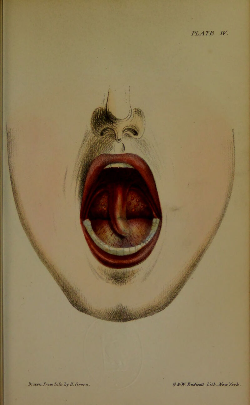 PLATFj IV.