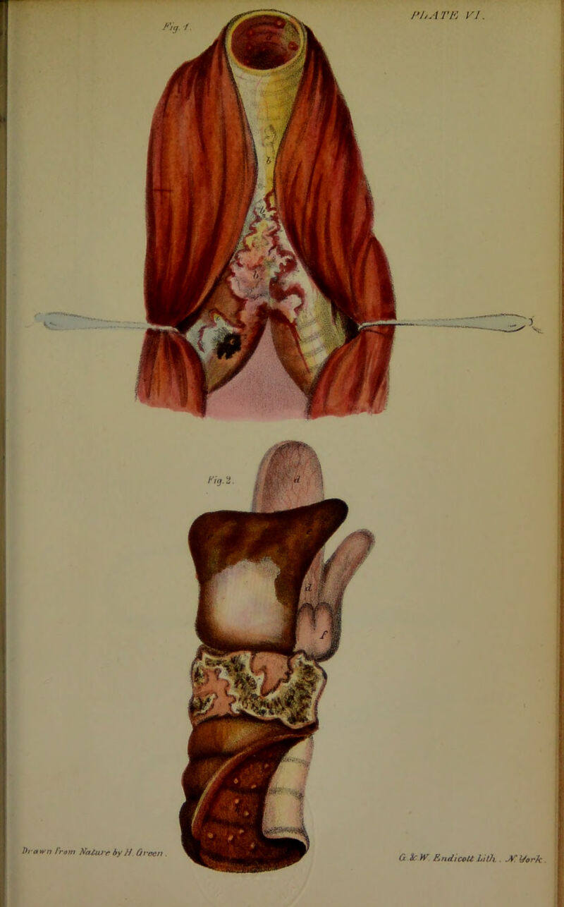 Fig. -/. I’hATK FI. brawn rmm Naitu r by H. Oroen . G irW EiidicoU LiOi. Jf. t/ork.