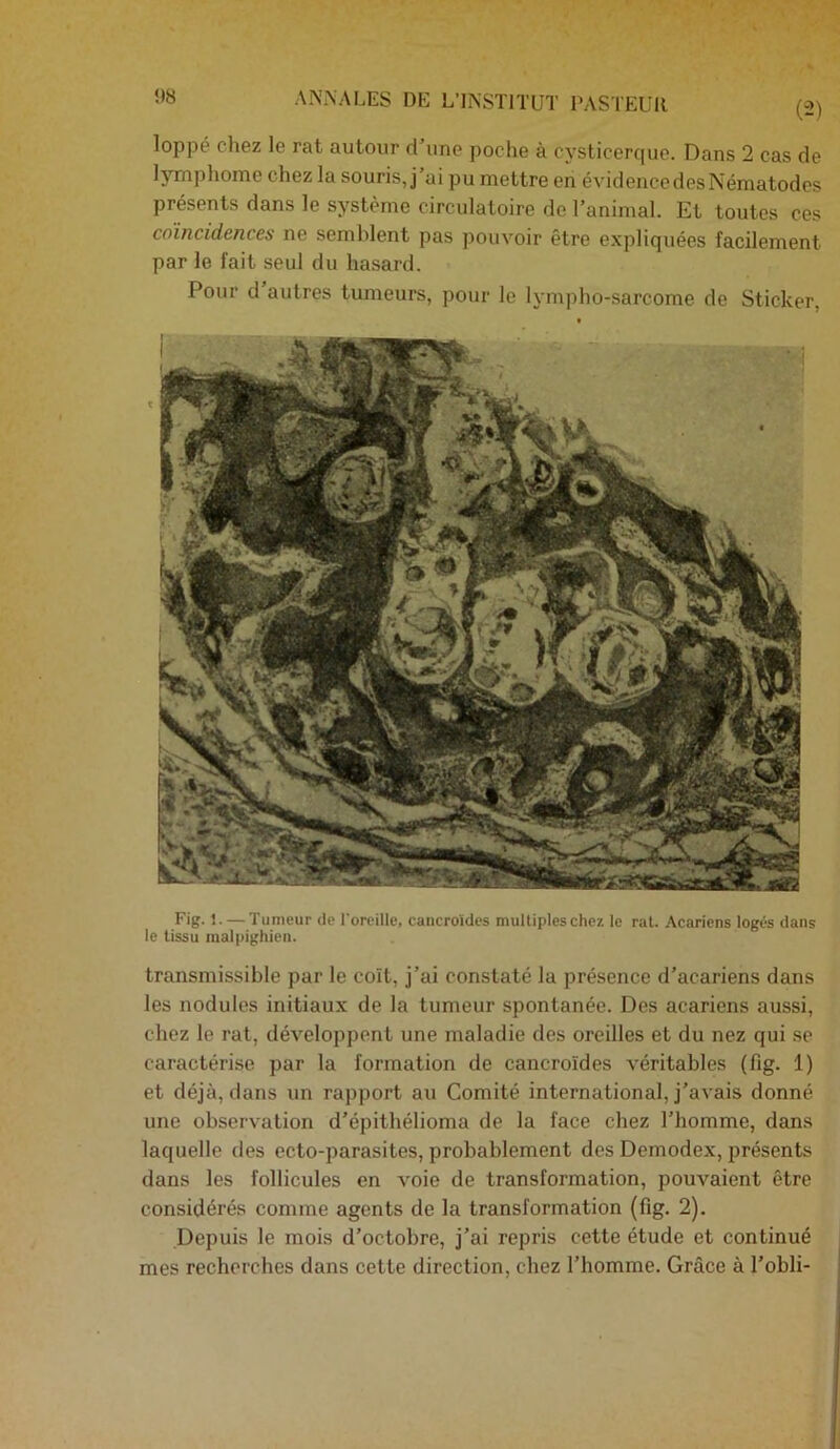 !>8 Fig-1- — Tumeur de l'oreille, cancro'ides multiples chez le rat. Acariens logés dans le tissu malpighien. transmissible par le coït, j’ai constaté la présence d’acariens dans les nodules initiaux de la tumeur spontanée. Des acariens aussi, chez le rat, développent une maladie des oreilles et du nez qui se caractérise par la formation de cancroïdes véritables (fig. 1) et déjà, dans un rapport au Comité international, j’avais donné une observation d’épithélioma de la face chez l’homme, dans laquelle des ecto-parasites, probablement des Demodex, présents dans les follicules en voie de transformation, pouvaient être considérés comme agents de la transformation (fig. 2). Depuis le mois d’octobre, j’ai repris cette étude et continué mes recherches dans cette direction, chez l’homme. Grâce à l’obli- .\.N.\.\LES DE L’INSTITUT PASTEUll (2) loppé chez le rat autour d’une poche à cysticerque. Dans 2 cas de lymphome chez la souris, j’ai pu mettre en évidencedesNématodes présents dans le système circulatoire de l’animal. Et toutes ces coïncidences ne semblent pas pouvoir être expliquées facilement par le fait seul du hasard. Pour d autres tumeurs, pour le lympho-sarcome de Sticker,