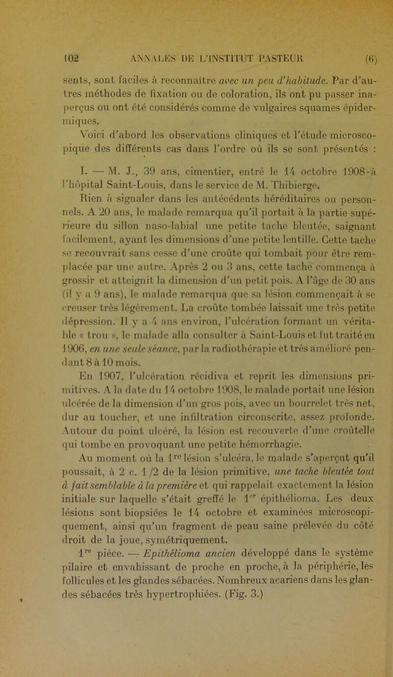 sents, sont faciles à reconnaître avec un peu d’habitude. Par d’au- tres méthodes de fixation ou de coloration, ils ont pu passer ina- perçus ou ont été considérés comme de vulgaires squames épider- miques. Voici d’abord les observations cliniques et l’étude microsco- pique des différents cas dans l’ordre où ils se sont présentés : I. — M. J., 39 ans, cimentier, entré le 14 octobre 1908-à l’hôpital Saint-Louis, dans le service de M. Tbibierge, Rien à signaler dans les antécédents héréditaires ou person- nels. A 20 ans, le malade remarqua qu’il portait à la partie supé- rieure du sillon naso-labial une petite tache bleutée, saignant facilement, ayant les dimensions d’une petite lentille. Cette tache se recouvrait sans cesse d’une croûte qui tombait pour être rem- placée par une autre. Après 2 ou 3 ans, cette tache commença à grossir et atteignit la dimension d’un petit pois. A l’âge de 30 ans (il y a 9 ans), le malade remarqua que sa lésion commençait à se creuser très légèrement. La croûte tombée laissait une très petite dépression. 11 y a 4 ans environ, l’ulcération formant un vérita- ble « trou », le malade alla consulter à Saint-Louis et fut traité en 1906, en une seule séance, par la radiothérapie et très amélioré pen- dant 8 à 10 mois. En 1907, l’ulcération récidiva et reprit les dimensions pri- mitives. A la date du 14 octobre 1908, le malade portait une lésion ulcérée de la dimension d’un gros pois, avec un bourrelet très net, dur au toucher, et une infiltration circonscrite, assez profonde. Autour du point ulcéré, la lésion est recouverte d’une croûtellc qui tombe en provoquant une petite hémorrhagie. Au moment où la l’’® lésion s’ulcéra, le malade s’aperçut qu’il poussait, à 2 c. 1 /2 de la lésion primitive, une tache bleutée tout d fait semblable à la première et qui rappelait exactement la lésion initiale sur laquelle s’était greffé le 1''’ épithélioma. Les deux lésions sont biopsiées le 14 octobre et examinées microscopi- quement, ainsi qu’un fragment de peau saine prélevée du côté droit de la joue, symétriquement. 1™ pièce. — Epithélioma ancien développé dans le système pilaire et envahissant de proche en proche, à la périphérie, les follicules et les glandes sébacées. Nombreux acariens dans les glan- des sébacées très hypertrophiées. (Fig. 3.)