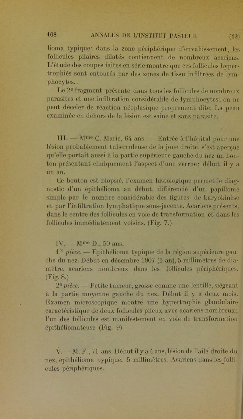 (12) lioma typique; dans la zone périphérique d’envahissement, les follicules pilaires dilatés contiennent de nombreux acariens. L’étude des coupes faites en série montre que ces follicules hyper- trophiés sont entourés par des zones do tissu infdtrées de lym- phocytes. . Le 2® fragment présente dans tous les follicules de nombreux parasites et une infdtration considérable de lymphocytes; on ne peut déceler de réaction néoplasique proprement dite. La peau examinée on dehors de la lésion est saine et sans j)arasite. 111. — C. Marie, 64 ans. — Entrée à l’hOpital pour une lésion probablement tuberculeuse de la joue droite, s’est aperçue qu(elle portait aussi à la partie supérieure gauche du nez un bou- ton présentant cliniquement l’aspect d’une verrue; début il y a un an. Ce bouton est biopsié. l’examen histologi(iue ])ermet le diag- nostic d’un épithélioma au début, dilTérencié d’un papillonie simple par le nombre considérable des ligures de karyokinèse et par l’infdtration lymphatique sous-jacente. Acariens présents, dans le centre des follicules en voie de transformation et dans les follicules immédiatement voisins. (Fig. 7.) IV. — M'”® D., 50 ans. pièce. — Epithélioma typique do la région supérieure gau che du nez. Début en décembre 1907 (1 an), 5 millimètres de dia- mètre, acariens nombreu.x dans les follicules périphériques. (Fig. 8.) 2® pièce. —Petite tumeur, grosse comme une lentille, siégeant à la partie moyenne gauche du nez. Début il y a doux mois. Examen microscopique montre une hypertrophie glandulaire caractéristique de deux follicules pileux avec acariens nombreux; l’un des follicules est manifestement en voie de transformation épithéliomateuse (Fig. 9). — M.F.,71 ans. Début il y a4 ans, lésion de l’aile droite du nez, épithélioma typique, 5 millimètres. .Acariens dans les folli- cules périphériques.