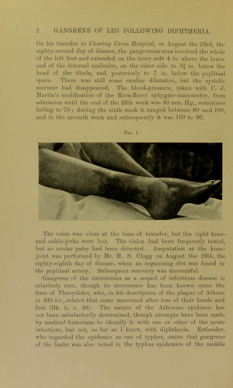 On liis transfer to Charing Cross Hospital, on August the 23rd, the eighty-second day of disease, the gangrenous area involved the whole of the left foot and extended on the inner side 4 in. above the lower end of the internal malleolus, on the outer side to 3J in. below the head of the fibula, and posteriorly to 7 in. below the popliteal space. There was still some cardiac dilatation, but the systolic murmur had disappeared. The blood-pressure, taken with C. J. Martin’s modification of the Riva-Rocci spliygmo-manometer, from admission until the end of the fifth week was 80 mm. Hg., sometimes falling to 70 ; during the sixth week it ranged between 80 and 100, and in the seventh week and subsequently it was 100 to 96. Fig. 1. The voice was clear at the time of transfer, but the right knee- and ankle-jerks were lost. The vision had been frequently tested, but no ocular palsy had been detected. Amputation at the knee- joint was performed by Mr. H. S. Clogg on August the 29th, the eighty-eighth day of disease, when an organising clot was found in the popliteal artery. Subsequent recovery was uneventful. Gangrene of the extremities as a sequel of infectious disease is relatively rare, though its occurrence has been known since the time of Thucydides, who, in his description of the plague of Athens in 430 b.c., relates that some recovered after loss of their hands and feet (Bk. ii, c. 49). The nature of the Athenian epidemic has not been satisfactorily determined, though attempts have been made by medical historians to identify it with one or other of the acute infections, but not, so far as I know, with diphtheria. Estlander, who regarded the epidemic as one of typhus, states that gangrene of the limbs was also noted in the typhus epidemics of the middle