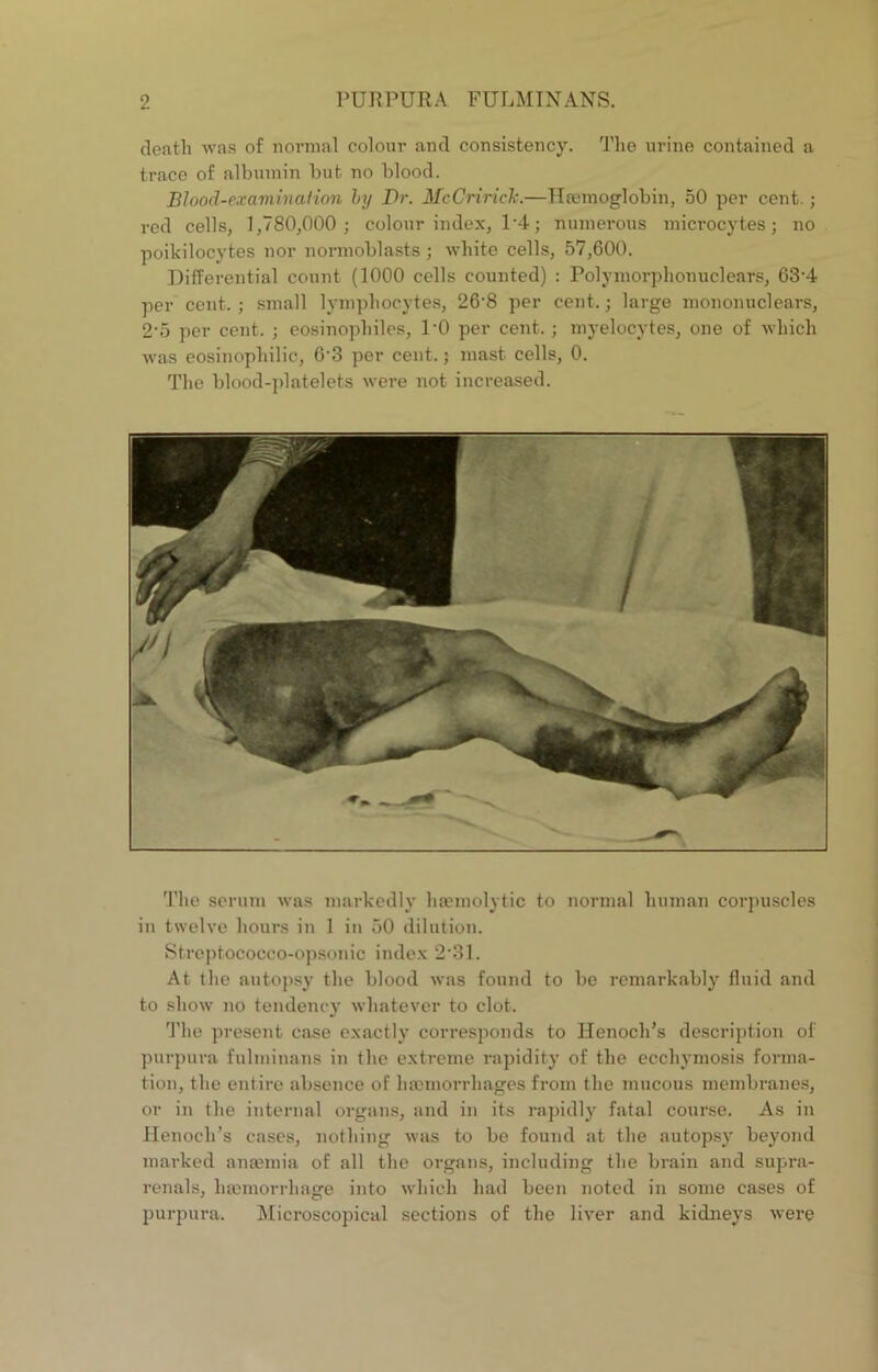 death was of normal colour and consistency. The urine contained a trace of albumin but no blood. Blood-examination by Dr. McCriricB.—Haemoglobin, 50 per cent.; red cells, 1,780,000; colour index, 1'4 ; numerous microcytes; no poikilocytes nor normoblasts ; white cells, 57,600. Differential count (1000 cells counted) : Polymorphonuclears, 63‘4 per cent. ; small lymphocytes, 26'8 per cent.; large mononuclears, 2-5 per cent. ; eosinophiles, l'O per cent. ; myelocytes, one of which was eosinophilic, 63 per cent, j mast cells, 0. The blood-platelets were not increased. The serum was markedly haemolytic to normal human corpuscles in twelve hours in 1 in 50 dilution. Strcptococco-opsonic index 2'31. At the autopsy the blood was found to be remarkably fluid and to show no tendency whatever to clot. The present case exactly corresponds to Henoch’s description of purpura fulminans in the extreme rapidity of the ecchymosis forma- tion, the entire absence of haemorrhages from the mucous membranes, or in the internal organs, and in its rapidly fatal course. As in Henoch’s cases, nothing was to be found at the autopsy beyond marked anaemia of all the organs, including the brain and supra- renals, haemorrhage into which had been noted in some cases of purpura. Microscopical sections of the liver and kidneys were