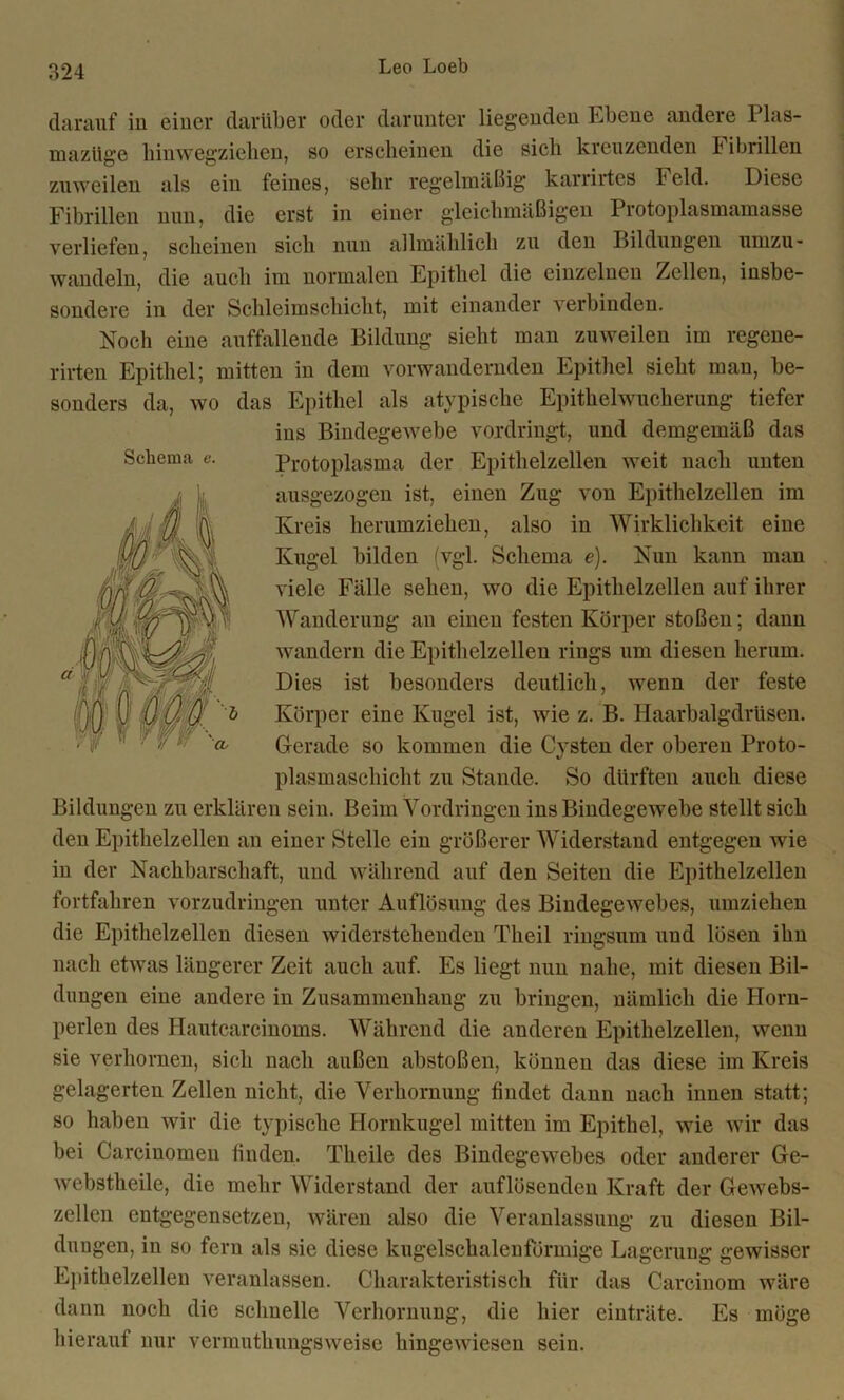 darauf in einer darüber oder darunter liegenden Ebene andere Plas- maztige binwegziehen, so erscheinen die sieb kreuzenden b ibrillen zuweilen als ein feines, sehr regelmäßig karrirtes Feld. Diese Fibrillen nun, die erst in einer gleichmäßigen Protoplasmamasse verliefen, scheinen sich nun allmählich zu den Bildungen umzu- wandeln, die auch im normalen Epithel die einzelnen Zellen, insbe- sondere in der Schleimschicht, mit einander verbinden. Noch eine auffallende Bildung sieht man zuweilen im regene- rirten Epithel; mitten in dem vorwandernden Epithel sieht man, be- sonders da, wo das Epithel als atypische Epithelwucherung tiefer ins Bindegewebe vordringt, und demgemäß das Protoplasma der Epithelzellen weit nach unten ausgezogen ist, einen Zug von Epithelzellen im Kreis herumziehen, also in Wirklichkeit eine Kugel bilden (vgl. Schema e). Nun kann man viele Fälle sehen, wo die Epithelzellen auf ihrer Wanderung an einen festen Körper stoßen; dann wandern die Epithelzellen rings um diesen herum. Dies ist besonders deutlich, wenn der feste Körper eine Kugel ist, wie z. B. Haarbalgdriisen. Gerade so kommen die Cysten der oberen Proto- plasmascbicht zu Stande. So dürften auch diese Bildungen zu erklären sein. Beim Vordringen ins Bindegewebe stellt sich den Epithelzellen an einer Stelle ein größerer Widerstand entgegen wie in der Nachbarschaft, und während auf den Seiten die Epithelzellen fortfahren vorzudringen unter Auflösung des Bindegewebes, umziehen die Epithelzellen diesen widerstehenden Theil ringsum und lösen ihn nach etwas längerer Zeit auch auf. Es liegt nun nahe, mit diesen Bil- dungen eine andere in Zusammenhang zu bringen, nämlich die Horn- perlen des Hautcarcinoms. Während die anderen Epithelzellen, wenn sie verhornen, sich nach außen abstoßen, können das diese im Kreis gelagerten Zellen nicht, die Verhornung findet dann nach innen statt; so haben wir die typische Hornkugel mitten im Epithel, wie wir das bei Carcinomen finden. Theile des Bindegewebes oder anderer Ge- webstheile, die mehr Widerstand der auflösenden Kraft der Gewebs- zellen entgegensetzen, wären also die Veranlassung zu diesen Bil- dungen, in so fern als sie diese kugelschaleuförmige Lageruug gewisser Epithelzellen veranlassen. Charakteristisch für das Carcinom wäre dann noch die schnelle Verhornung, die hier einträte. Es möge hierauf nur vermutliungsweise hingewiesen sein. Schema e.