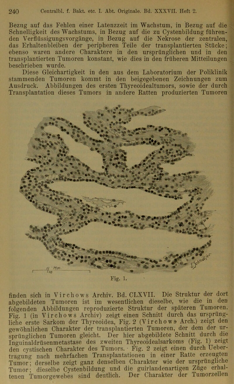 Bezug auf das Fehlen einer Latenzzeit im Wachstum, in Bezug auf die Schnelligkeit des Wachstums, in Bezug auf die zu Cystenbildung führen- den Verflüssigungsvorgänge, in Bezug auf die Nekrose der zentralen, das Erhaltenbleiben der peripheren Teile der transplantierten Stücke; ebenso waren andere Charaktere in den ursprünglichen und in den transplantierten Tumoren konstant, wie dies in den früheren Mitteilungen beschrieben wurde. Diese Gleichartigkeit in den aus dem Laboratorium der Poliklinik stammenden Tumoren kommt in den beigegebenen Zeichnungen zum Ausdruck. Abbildungen des ersten Thyreoidealtumors, sowie der durch Transplantation dieses Tumors in andere Ratten produzierten Tumoren « »• t' * • * • * # * *»• * \ •s* • v ^ - - a •ty« X U nn> **•••• /o Fig. 1. finden sich in Virchows Archiv. Bd. CLXVII. Die Struktur der dort abgebildeten Tumoren ist im wesentlichen dieselbe, wie die in den folgenden Abbildungen reproduzierte Struktur der späteren Tumoren. Fig. 1 (in Virchows Archiv) zeigt einen Schnitt durch das ursprüng- liche erste Sarkom der Thyreoidea, Fig. 2 (Virchows Arch.) zeigt den gewöhnlichen Charakter der transplantierten Tumoren, der dem der ur- sprünglichen Tumoren gleicht. Der hier abgebildete Schnitt durch die Inguinaldrüsenmetastase des zweiten Thyreoidealsarkoms (Fig. 1) zeigt den cystischen Charakter des Tumors. Fig. 2 zeigt einen durch Ueber- tragung nach mehrfachen Transplantationen in einer Ratte erzeugten Tumor; derselbe zeigt ganz denselben Charakter wie der ursprüngliche Tumor; dieselbe Cystenbildung und die guirlandenartigen Züge erhal- tenen Tumorgewebes sind deutlich. Der Charakter der Tumorzeilen