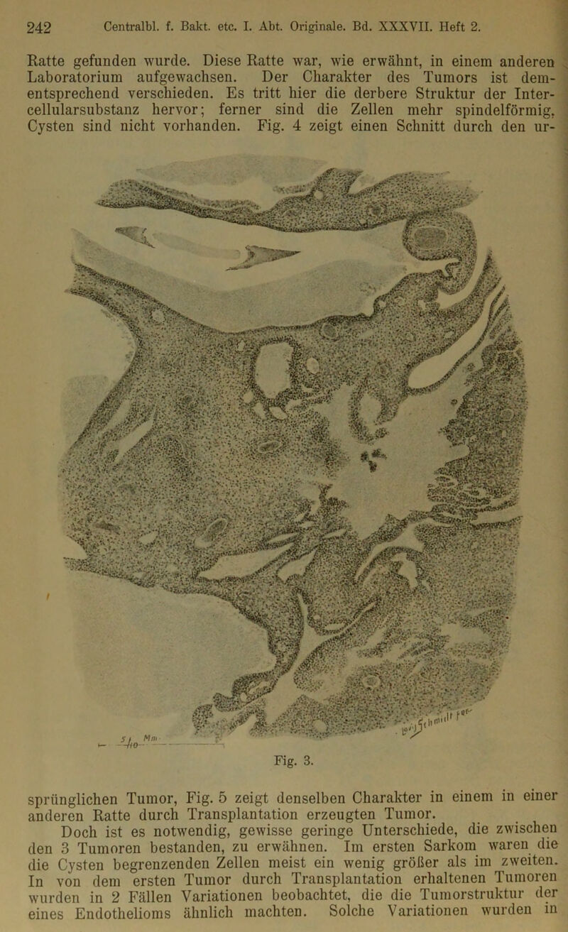 Ratte gefunden wurde. Diese Ratte war, wie erwähnt, in einem anderen Laboratorium aufgewachsen. Der Charakter des Tumors ist dem- entsprechend verschieden. Es tritt hier die derbere Struktur der Inter- cellularsubstanz hervor; ferner sind die Zellen mehr spindelförmig. Cysten sind nicht vorhanden. Fig. 4 zeigt einen Schnitt durch den ur- Fig. 3. spriinglichen Tumor, Fig. 5 zeigt denselben Charakter in einem in einer anderen Ratte durch Transplantation erzeugten Tumor. Doch ist es notwendig, gewisse geringe Unterschiede, die zwischen den 3 Tumoren bestanden, zu erwähnen. Im ersten Sarkom waren die die Cysten begrenzenden Zellen meist ein wenig größer als im zweiten. In von dem ersten Tumor durch Transplantation erhaltenen Tumoren wurden in 2 Fällen Variationen beobachtet, die die Tumorstruktur der eines Endothelioms ähnlich machten. Solche Variationen wurden in