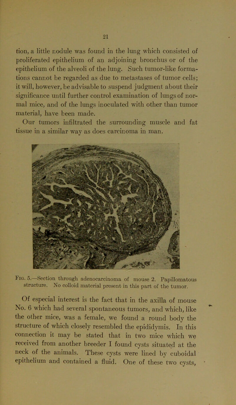 tion, a little nodule was found in the lung which consisted of proliferated epithelium of an adjoining bronchus or of the epithelium of the alveoli of the lung. Such tumor-like forma- tions cannot be regarded as due to metastases of tumor cells; it will, however, be advisable to suspend judgment about their significance until further control examination of lungs of nor- mal mice, and of the lungs inoculated with other than tumor material, have been made. Our tumors infiltrated the surrounding muscle and fat tissue in a similar way as does carcinoma in man. Fig. 5.—Section through adenocarcinoma of mouse 2. Papillomatous structure. No colloid material present in this part of the tumor. Of especial interest is the fact that in the axilla of mouse No. 6 which had several spontaneous tumors, and which, like the other mice, was a female, we found a round body the structure of which closely resembled the epididymis. In this connection it may be stated that in two mice which we received from another breeder I found cysts situated at the neck of the animals. These cysts were lined by cuboidal epithelium and contained a fluid. One of these two cysts,