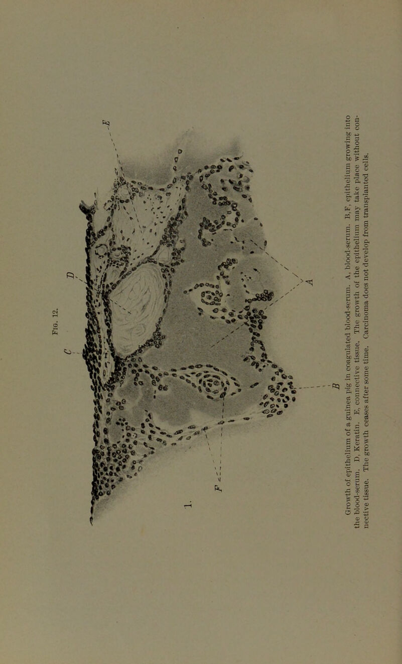 v \ o --Rq Growth of epithelium of a guinea pig in coagulated blood-serum. A, blood-serum. B,F, epithelium growing into nective tissue. The growth ceases after some time. Carcinoma does not develop from transplanted cells.