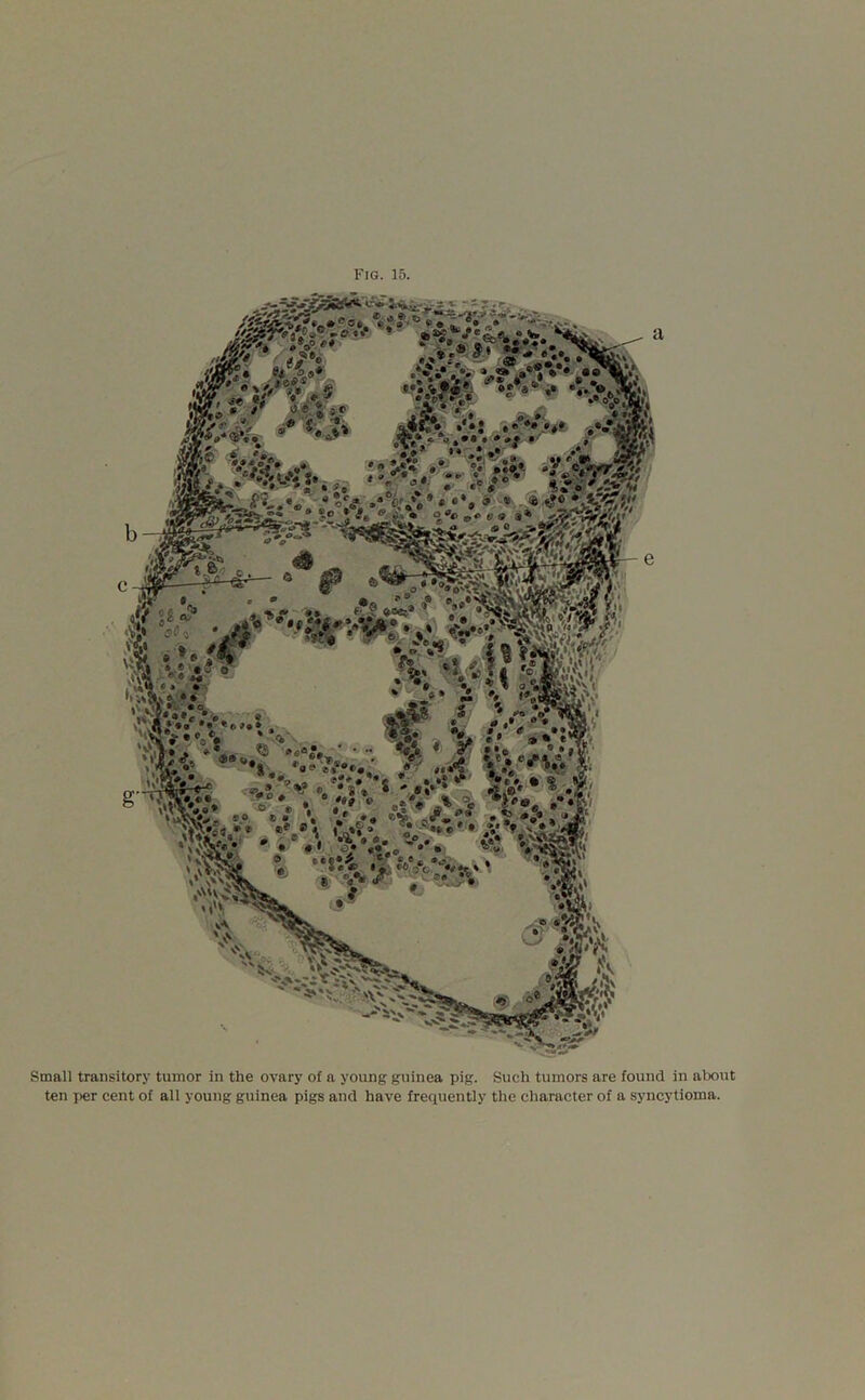 Small transitory tumor in the ovary of a young guinea pig. Such tumors are found in about ten per cent of all young guinea pigs and have frequently the character of a syncytioma.