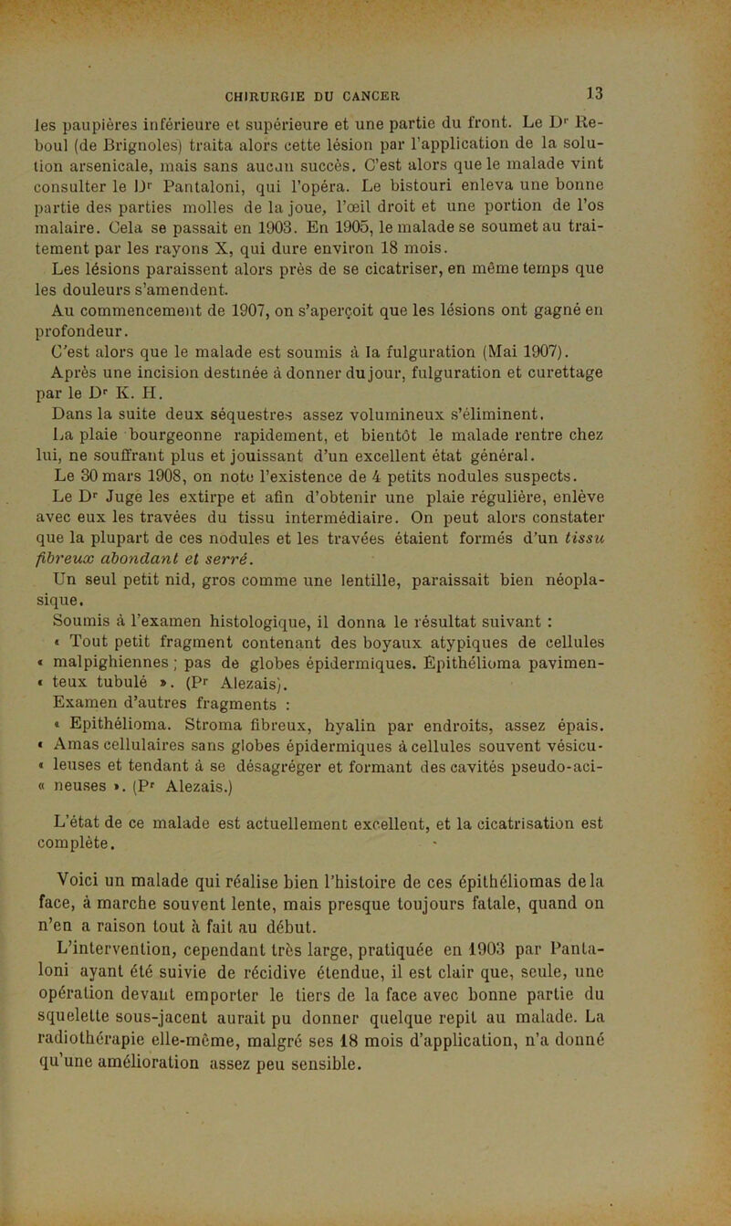 les paupières inférieure et supérieure et une partie du front. Le D'' Re- boul (de Brignoles) traita alors cette lésion par l’application de la solu- tion arsenicale, mais sans aucun succès. C’est alors que le malade vint consulter le D>' Pantalon!, qui l’opéra. Le bistouri enleva une bonne partie des parties molles de la joue, l’oeil droit et une portion de l’os malaire. Cela se passait en 1903. En 1905, le malade se soumet au trai- tement par les rayons X, qui dure environ 18 mois. Les lésions paraissent alors près de se cicatriser, en même temps que les douleurs s’amendent. Au commencement de 1907, on s’aperçoit que les lésions ont gagné en profondeur. C’est alors que le malade est soumis à la fulguration (Mai 1907). Après une incision destinée à donner du jour, fulguration et curettage par le K. H. Dans la suite deux séquestres assez volumineux s’éliminent. La plaie bourgeonne rapidement, et bientôt le malade rentre chez lui, ne .souffrant plus et jouissant d’un excellent état général. Le 30 mars 1908, on note l’existence de 4 petits nodules suspects. Le D’’ Juge les extirpe et afin d’obtenir une plaie régulière, enlève avec eux les travées du tissu intermédiaire. On peut alors constater que la plupart de ces nodules et les travées étaient formés d’un tissu fibreux abondant et serré. Un seul petit nid, gros comme une lentille, paraissait bien néopla- sique. Soumis à l’examen histologique, il donna le résultat suivant : « Tout petit fragment contenant des boyaux atypiques de cellules « malpighiennes ; pas de globes épidermiques. Epithélioma pavimen- i teux tubulé *. (Pr Alezais). Examen d’autres fragments : » Epithélioma. Stroma fibreux, hyalin par endroits, assez épais. * Amas cellulaires sans globes épidermiques à cellules souvent vésicu- « leuses et tendant à se désagréger et formant des cavités pseudo-aci- « neuses ». (P^ Alezais.) L’état de ce malade est actuellement excellent, et la cicatrisation est complète. Voici un malade qui réalise bien l’histoire de ces épilhéliomas delà face, à marche souvent lente, mais presque toujours fatale, quand on n’en a raison tout à fait au début. L’intervention, cependant très large, pratiquée en 1903 par Panta- loni ayant été suivie de récidive étendue, il est clair que, seule, une opération devant emporter le tiers de la face avec bonne partie du squelette sous-jacent aurait pu donner quelque répit au malade. La radiothérapie elle-même, malgré ses 18 mois d’application, n’a donné qu’une amélioration assez peu sensible.