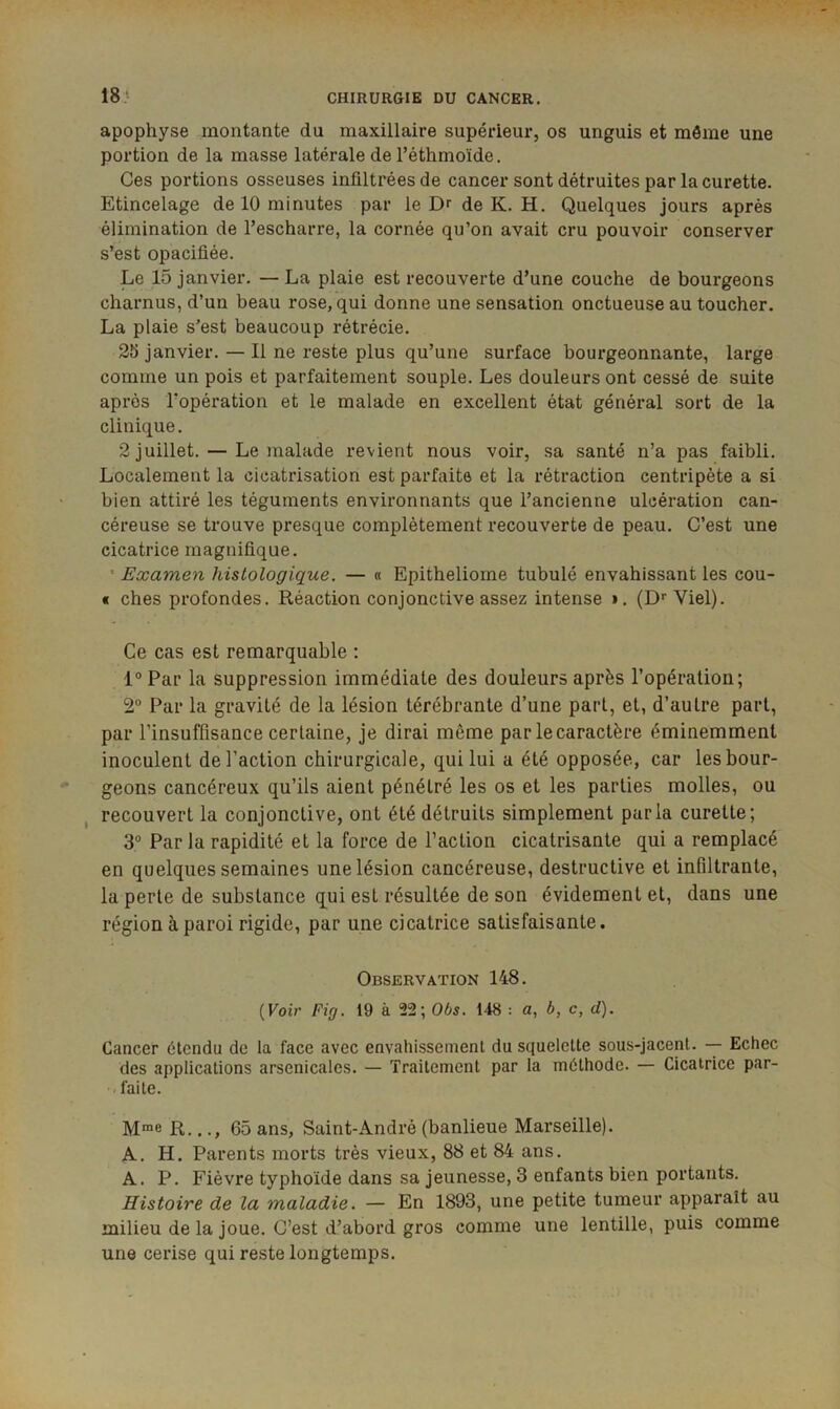 18} apophyse montante du maxillaire supérieur, os unguis et môme une portion de la masse latérale de l’éthmoïde. Ces portions osseuses infiltrées de cancer sont détruites par la curette. Etincelage de 10 minutes par le Dr de K. H. Quelques jours après élimination de l’escharre, la cornée qu’on avait cru pouvoir conserver s’est opacifiée. Le 15 janvier. — La plaie est recouverte d’une couche de bourgeons charnus, d’un beau rose, qui donne une sensation onctueuse au toucher. La plaie s'est beaucoup rétrécie. 25 janvier. — Il ne reste plus qu’une surface bourgeonnante, large comme un pois et parfaitement souple. Les douleurs ont cessé de suite après l’opération et le malade en excellent état général sort de la clinique. 2 juillet. — Le malade revient nous voir, sa santé n’a pas faibli. Localement la cicatrisation est parfaite et la rétraction centripète a si bien attiré les téguments environnants que l’ancienne ulcération can- céreuse se trouve presque complètement recouverte de peau. C’est une cicatrice magnifique. ' Examen histologique. — « Epitheliorne tubulé envahissant les cou- f ches profondes. Réaction conjonctive assez intense i. (D‘‘Viel). Ce cas est remarquable : 1° Par la suppression immédiate des douleurs après l’opératiou; 2° Par la gravité de la lésion térébrante d’une part, et, d’autre part, par l’insuffisance certaine, je dirai même par le caractère éminemment inoculent de l’action chirurgicale, qui lui a été opposée, car les bour- geons cancéreux qu’ils aient pénétré les os et les parties molles, ou , recouvert la conjonctive, ont été détruits simplement parla curette; 3“ Parla rapidité et la force de l’action cicatrisante qui a remplacé en quelques semaines une lésion cancéreuse, destructive et infiltrante, la perte de substance qui est résultée de son évidement et, dans une région à paroi rigide, par une cicatrice satisfaisante. Observation 148. [Voir Fig. 19 à 22; 065. 148 : a, b, c, d). Cancer étendu de la face avec envahissement du squelette sous-jacent. -- Echec des applications arsenicales. — Traitement par la méthode. — Cicatrice par- •-faite. R..65 ans, Saint-André (banlieue Marseille). A. H. Parents morts très vieux, 88 et 84 ans. A. P. Fièvre typhoïde dans sa jeunesse, 3 enfants bien portants. Histoire de la maladie. — En 1893, une petite tumeur apparaît au milieu de la joue. C’est d’abord gros comme une lentille, puis comme une cerise qui reste longtemps.