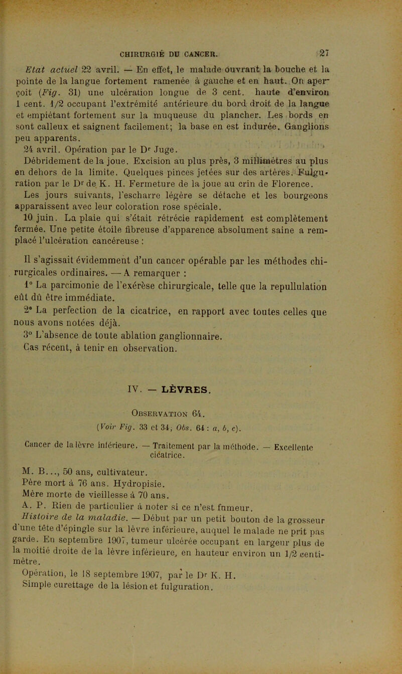 Etat actuel 22 avril, — En effet, le malade ouvrant la bouche et la pointe de la langue fortement ramenée à gauche et en haut. On aper çoit {Fig. 31) une ulcération longue de 3 cent, haute d’environ 1 cent. 1/2 occupant l’extrémité antérieure du bord droit de la langue et empiétant fortement sur la muqueuse du plancher. Les .bords ^ en sont calleux et saignent facilement; la base en est indurée. Ganglions peu apparents. ■ > , 24 avril. Opération par le D' Juge. ’ Débridement delà joue. Excision au plus près, 3 millimétrés au plus en dehors de la limite. Quelques pinces jetées sur des artères. Eulgu- ration par le D^de. K. H. Fermeture de la joue au crin de Florence. Les jours suivants, l'escharre légère se détache et les bourgeons apparaissent avec leur coloration rose spéciale. 10 juin. La plaie qui s’était rétrécie rapidement est complètement fermée. Une petite étoile fibreuse d’apparence absolument saine a rem- placé l’ulcération cancéreuse : 11 s’agissait évidemment d’un cancer opérable par les méthodes chi- rurgicales ordinaires. — A remarquer : 1° La parcimonie de l’exérèse chirurgicale, telle que la repullulation eût dû être immédiate. 2® La perfection de la cicatrice, en rapport avec toutes celles que nous avons notées déjà. 3“ L’absence de toute ablation ganglionnaire. Cas récent, à tenir en observation. IV. — LÈVRES. Observation 64. [Voir Fig. 33 et 34, Oôs. 64 : a, ô, c). Cancer de la lèvre inférieure. — Traitement par la méthode. — Excellente ciéatrice. M. B..., 50 ans, cultivateur. Père mort à 76 ans. Hydropisie. Mère morte de vieillesse à 70 ans. A, P. Rien de particulier à noter si ce n’est fnmeur. Histoire de la maladie. — Début par un petit bouton de la grosseur d une tête d épingle sur la lèvre inférieure, auquel le malade ne prit pas garde. En septembre 1907, tumeur ulcérée occupant en largeur plus de la moitié droite de la lèvre inférieure, en hauteur environ un 1/2 centi- mètre. Opération, le 18 septembre 1907, par le Dr K. H. Simple curettage de la lésion et fulguration.