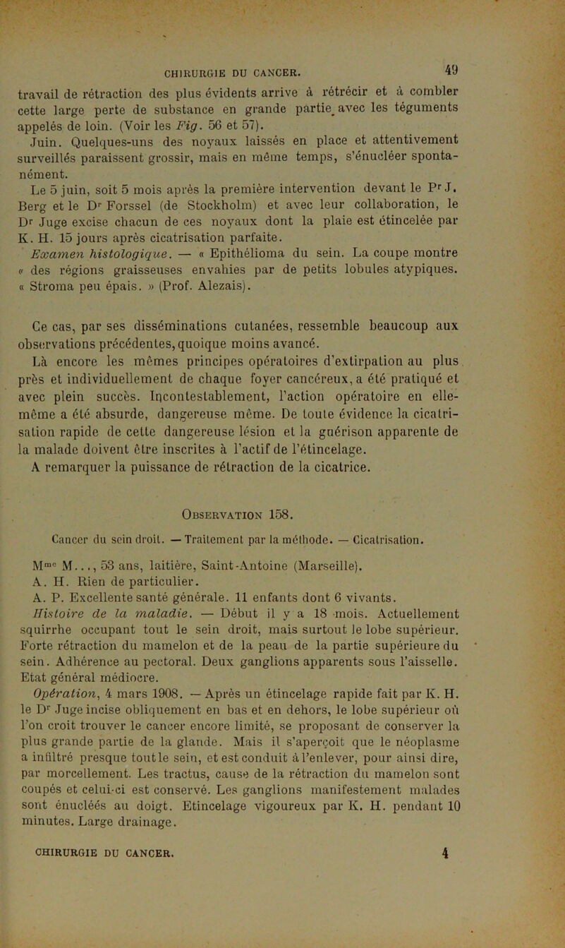 travail de rétraction des plus évidents arrive à rétrécir et à combler cette large perte de substance en grande partie^ avec les téguments appelés de loin. (Voir les Fig. 56 et 57). Juin. Quelques-uns des noyaux laissés en place et attentivement surveillés paraissent grossir, mais en môme temps, s’énucléer sponta- nément. Le 5 juin, soit 5 mois après la première intervention devant le Pr J. Berg et le D*- Forssel (de Stockholm) et avec leur collaboration, le Dr Juge excise chacun de ces noyaux dont la plaie est étincelée par K. H. 15 jours après cicatrisation parfaite. Examen histologique. — « Epithélioma du sein. La coupe montre « des régions graisseuses envahies par de petits lobules atypiques. « Stroma peu épais. » (Prof. Alezais). Ce cas, par ses disséminations cutanées, ressemble beaucoup aux observations précédentes, quoique moins avancé. Là encore les mômes principes opératoires d’extirpation au plus près et individuellement de chaque foyer cancéreux, a été pratiqué et avec plein succès. Incontestablement, l’action opératoire en elle- même a été absurde, dangereuse môme. De toute évidence la cicatri- sation rapide de cette dangereuse lésion et la guérison apparente de la malade doivent être inscrites à l’actif de l’étincelage. A remarquer la puissance de rétraction de la cicatrice. Observation 158. Cancer du sein droit. — Traitement par la méthode. — Cicatrisation. M..., 53 ans, laitière, Saint-Antoine (Marseille). A. H. Rien de particulier. A. P. Excellente santé générale. 11 enfants dont 6 vivants. Histoire de la maladie. — Début il y a 18 mois. Actuellement squirrhe occupant tout le sein droit, mais surtout le lobe supérieur. Forte rétraction du mamelon et de la peau de la partie supérieure du sein. Adhérence au pectoral. Deux ganglions apparents sous l’aisselle. Etat général médiocre. Opération, 4 mars 1908. — Après un étincelage rapide fait par K. H. le D Juge incise obliquement en bas et en dehors, le lobe supérieur où l’on croit trouver le cancer encore limité, se proposant de conserver la plus grande partie de la glande. Mais il s’aperçoit que le néoplasme a infiltré presque tout le sein, et est conduit à l’enlever, pour ainsi dire, par morcellement. Les tractus, cause de la rétraction du mamelon sont coupés et celui-ci est conservé. Les ganglions manifestement malades sont énucléés au doigt. Etincelage vigoureux par K. H. pendant 10 minutes. Large drainage. CHIRURGIE DU CANCER. 4