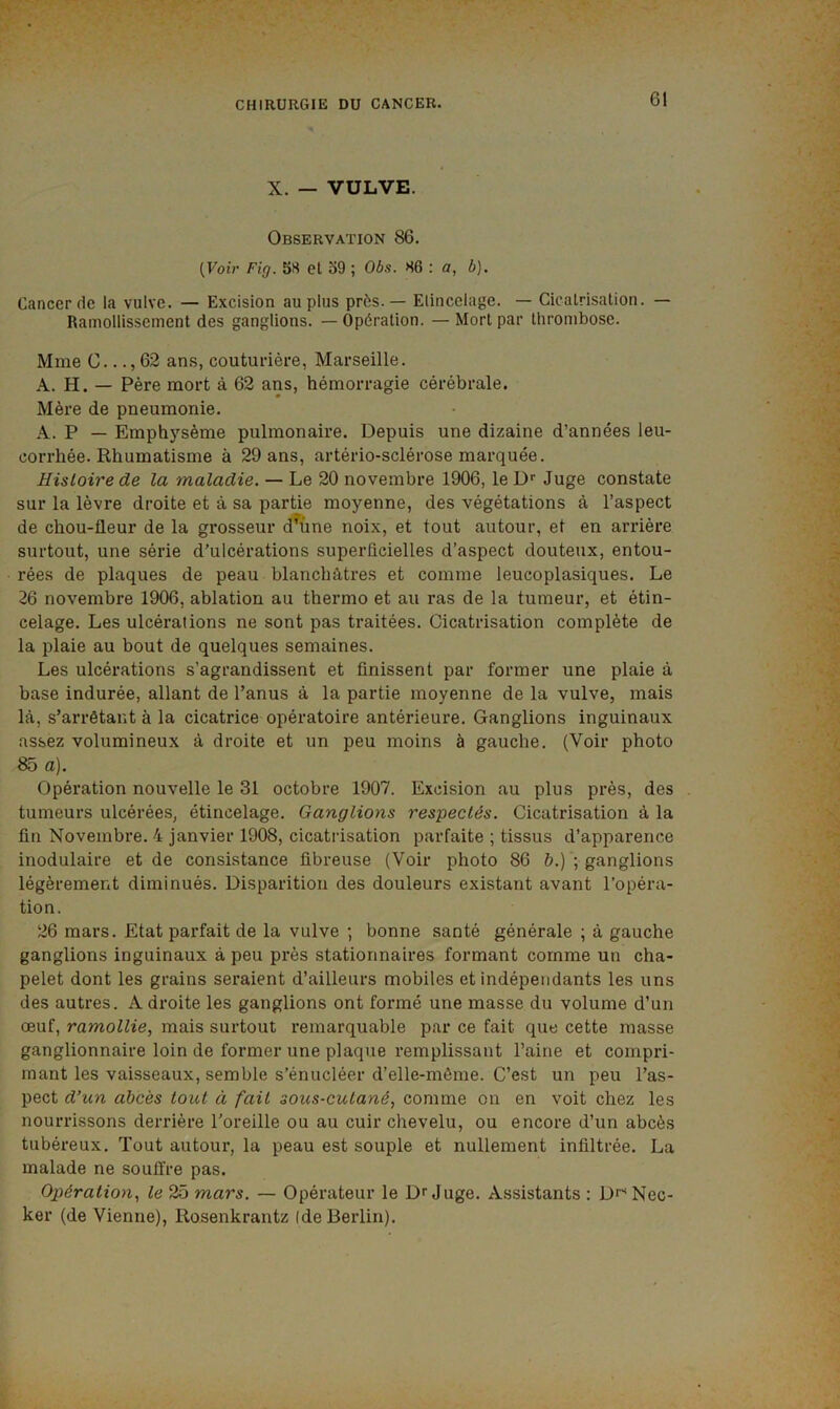 X. — VULVE. Observation 86. {Voir Fig. 58 et 59 ; Ob.<s. 86 : a, b). Cancer de la vulve. — Excision au plus près. — Elincclage. — Cicatrisation. — Ramollissement des ganglions. — Opération. — Mort par thrombose. Mme C..., 62 ans, couturière, Marseille. A. H. — Père mort à 62 ans, hémorragie cérébrale. Mère de pneumonie. A. P — Emphysème pulmonaire. Depuis une dizaine d’années leu- corrhée. Rhumatisme à 29 ans, artério-sclérose marquée. Histoire de la maladie. — Le 20 novembre 1906, le D‘‘ Juge constate sur la lèvre droite et à sa partie moyenne, des végétations à l’aspect de chou-fleur de la grosseur d^ùne noix, et tout autour, et en arrière surtout, une série d’ulcérations superfleielles d’aspect douteux, entou- rées de plaques de peau blanchâtres et comme leucoplasiques. Le 26 novembre 1906, ablation au thermo et au ras de la tumeur, et étin- celage. Les ulcérations ne sont pas traitées. Cicatrisation complète de la plaie au bout de quelques semaines. Les ulcérations s’agrandissent et finissent par former une plaie à base indurée, allant de l’anus à la partie moyenne de la vulve, mais là, s’arrêtant à la cicatrice opératoire antérieure. Ganglions inguinaux assez volumineux à droite et un peu moins à gauche. (Voir photo 85 a). Opération nouvelle le 31 octobre 1907. Excision au plus près, des tumeurs ulcérées, étincelage. Ganglions respectés. Cicatrisation à la fin Novembre. 4 janvier 1908, cicatrisation parfaite ; tissus d’apparence inodulaire et de consistance fibreuse (Voir photo 86 &.) ; ganglions légèrement diminués. Disparition des douleurs existant avant l’opéra- tion. 26 mars. Etat parfait de la vulve ; bonne santé générale ; à gauche ganglions inguinaux à peu près stationnaires formant comme un cha- pelet dont les grains seraient d’ailleurs mobiles et indépendants les uns des autres. A droite les ganglions ont formé une masse du volume d’un œuf, ramollie, mais surtout remarquable par ce fait que cette masse ganglionnaire loin de former une plaque remplissant l’aine et compri- mant les vaisseaux, semble s’énucléer d’elle-même. C’est un peu l’as- pect d’nn abcès tout à fait sous-cutané, comme on en voit chez les nourrissons derrière l’oreille ou au cuir chevelu, ou encore d’un abcès tubéreux. Tout autour, la peau est souple et nullement infiltrée. La malade ne souffre pas. Opération, te 25 mars. — Opérateur le Déjuge. Assistants : Di^Nec- ker (de Vienne), Rosenkrantz (de Berlin).